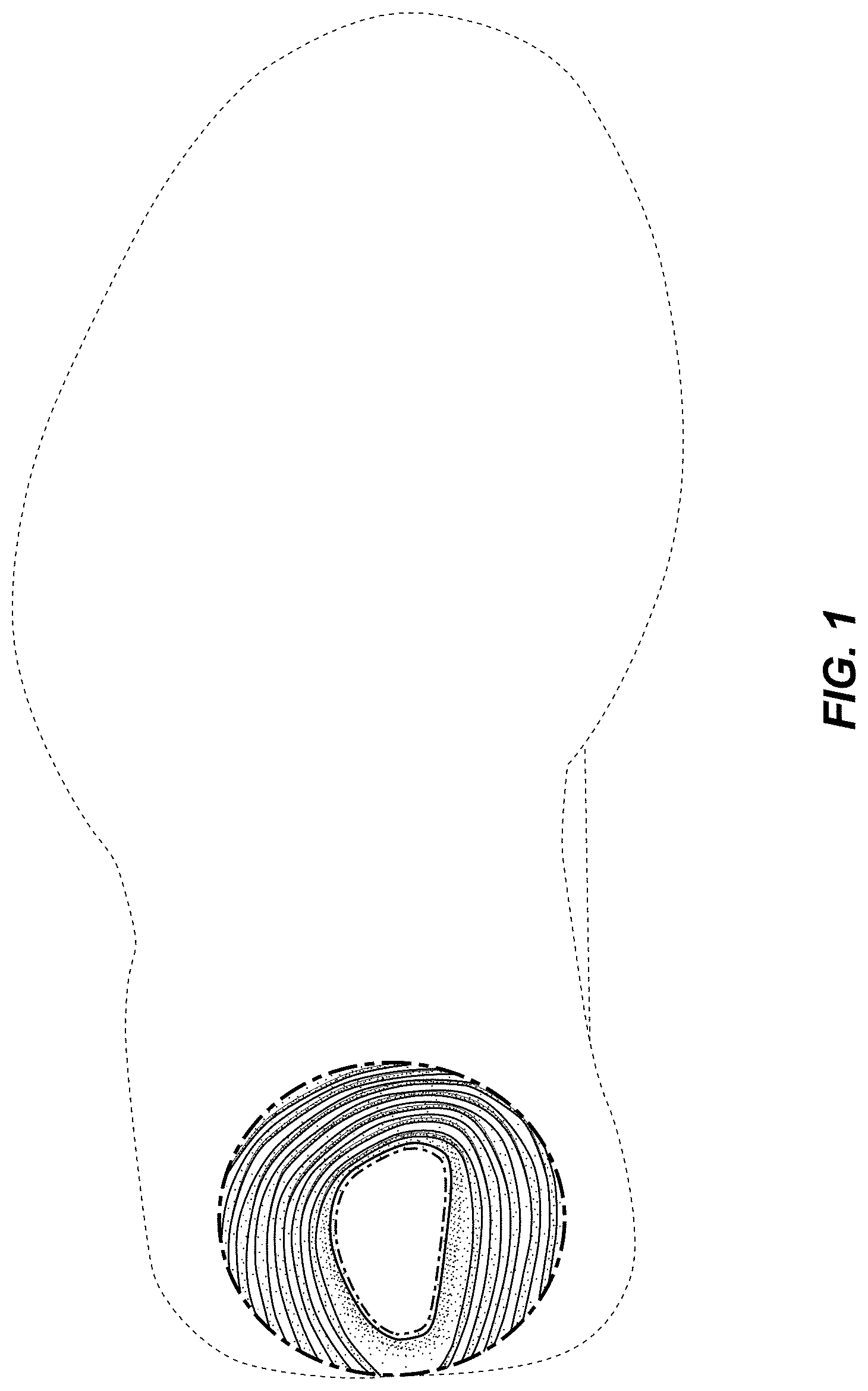 Patent USD0999500 Figure 1 – Shoe