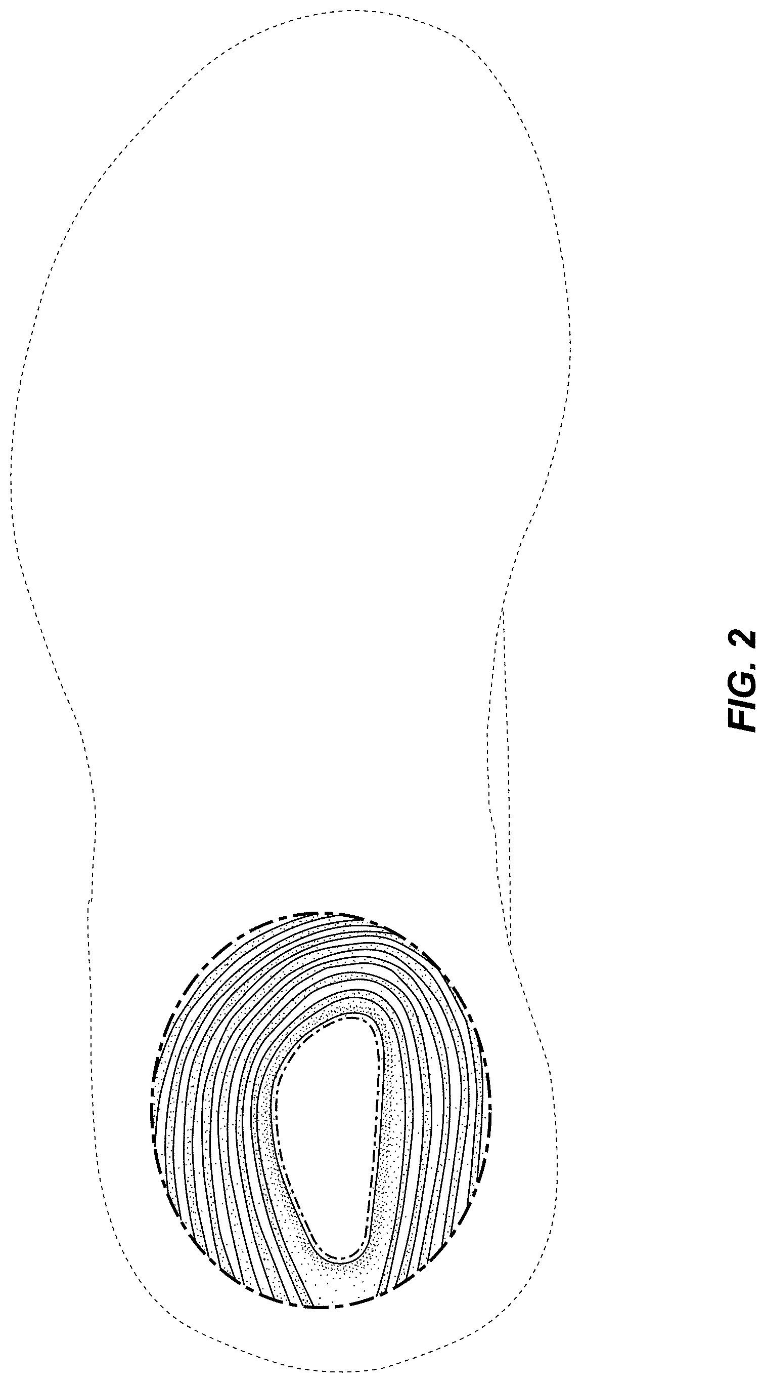 Patent USD0999500 Figure 2 – Shoe