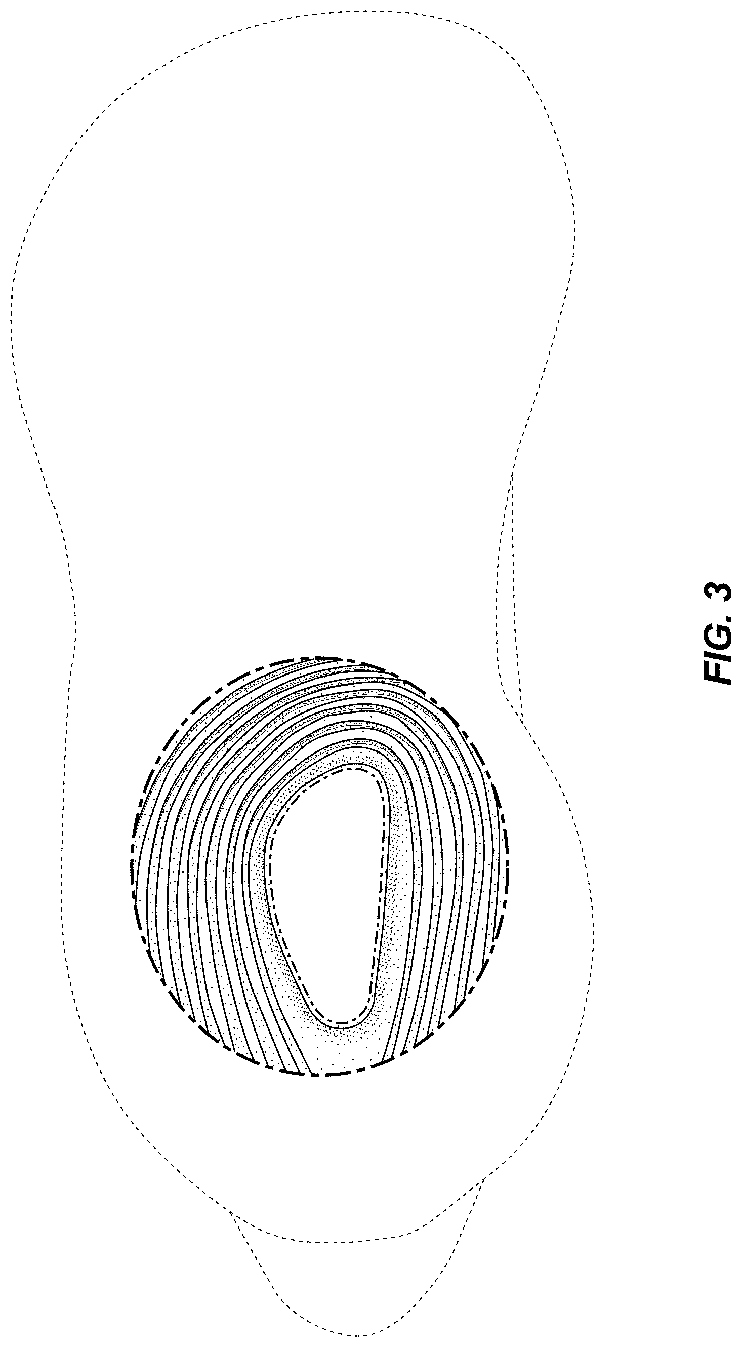 Patent USD0999500 Figure 3 – Shoe