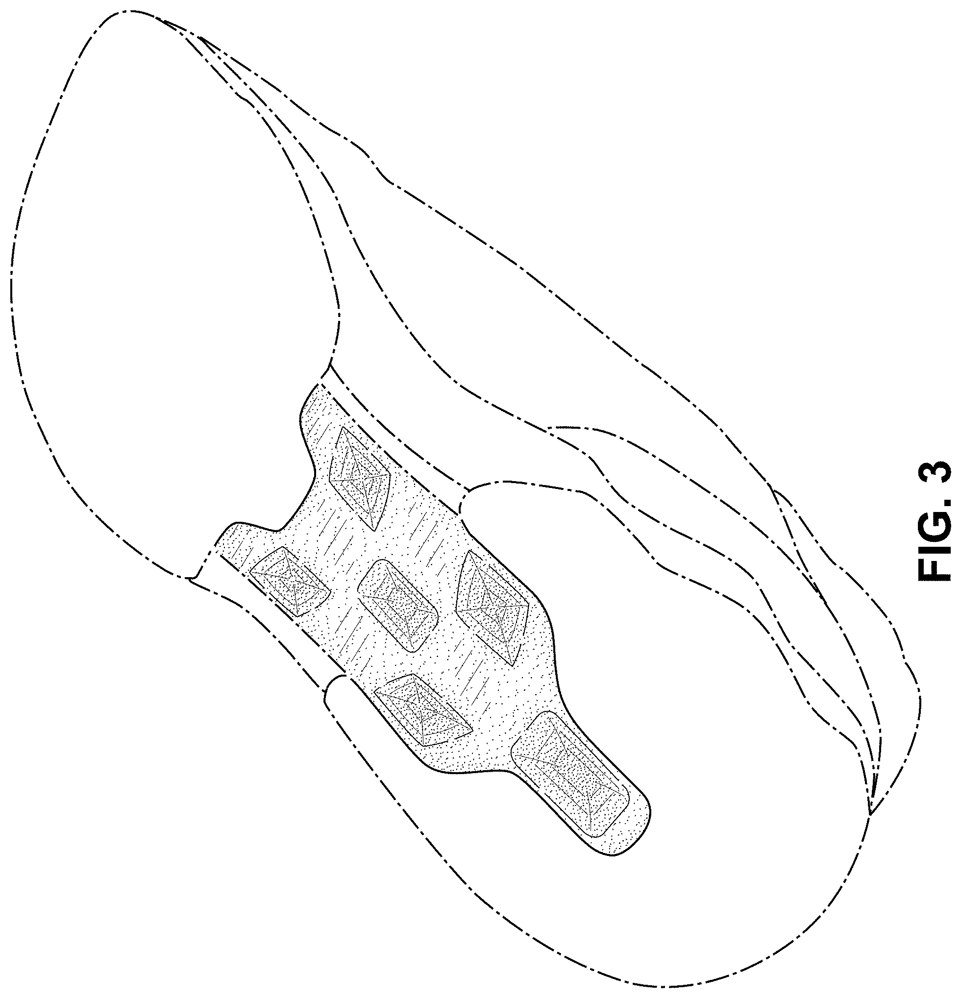 Patent USD0999503 Figure 3 – Shoe