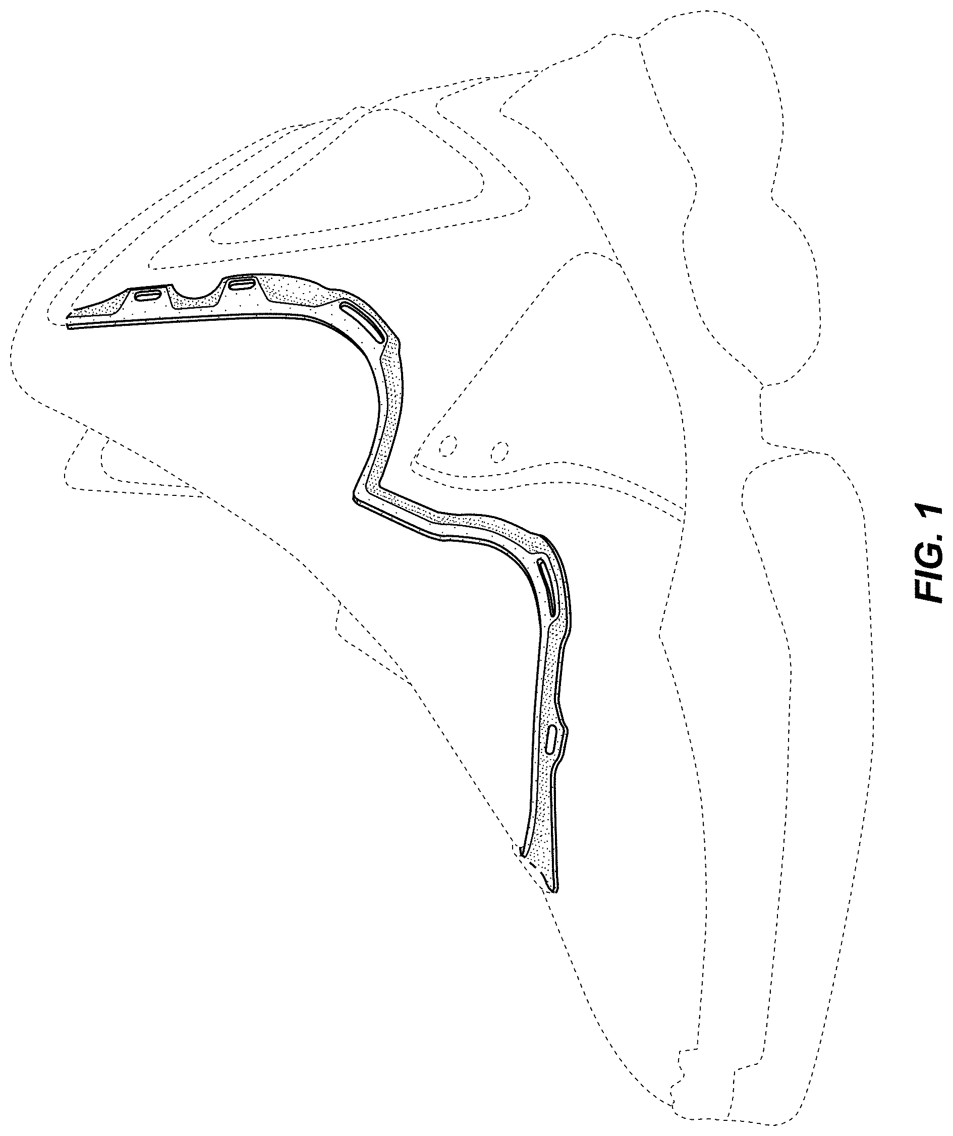 Patent USD0999509 Figure 1 – Shoe