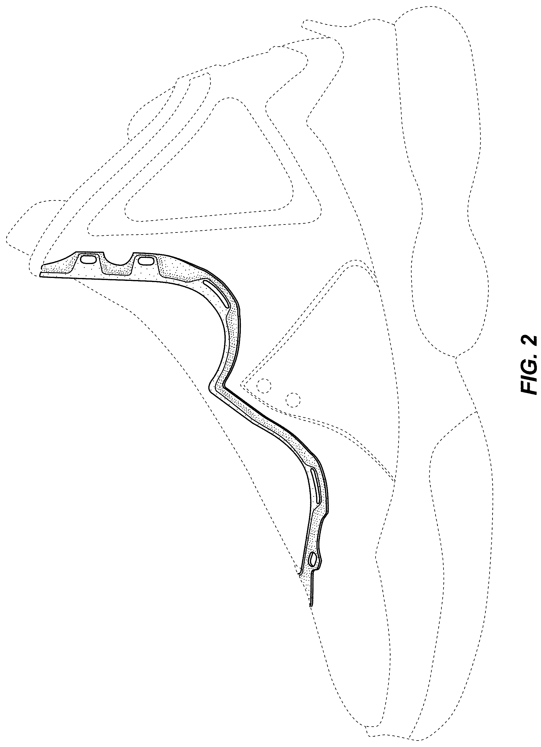 Patent USD0999509 Figure 2 – Shoe