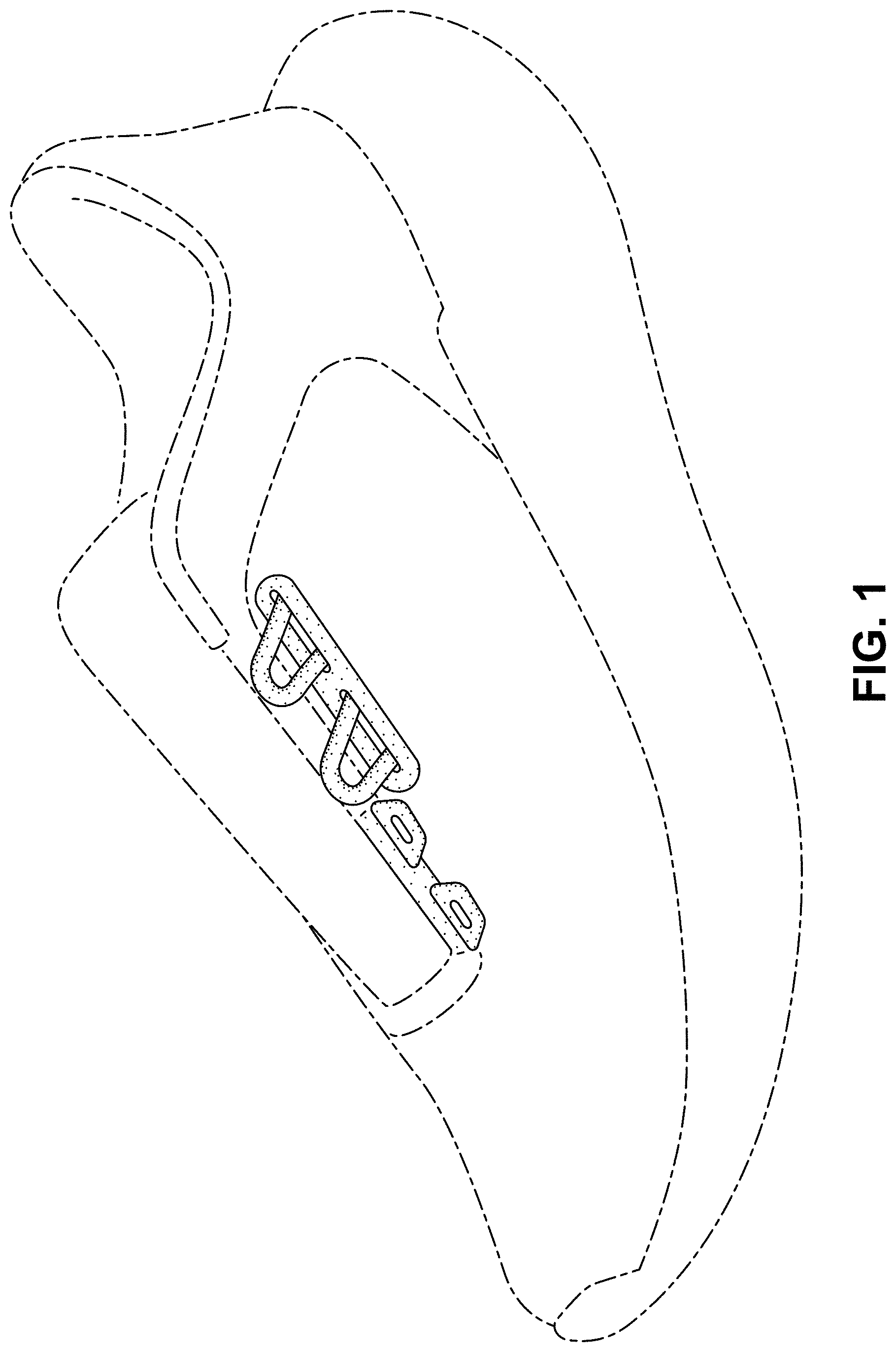 Patent USD0999512 — Shoe — Figure 1