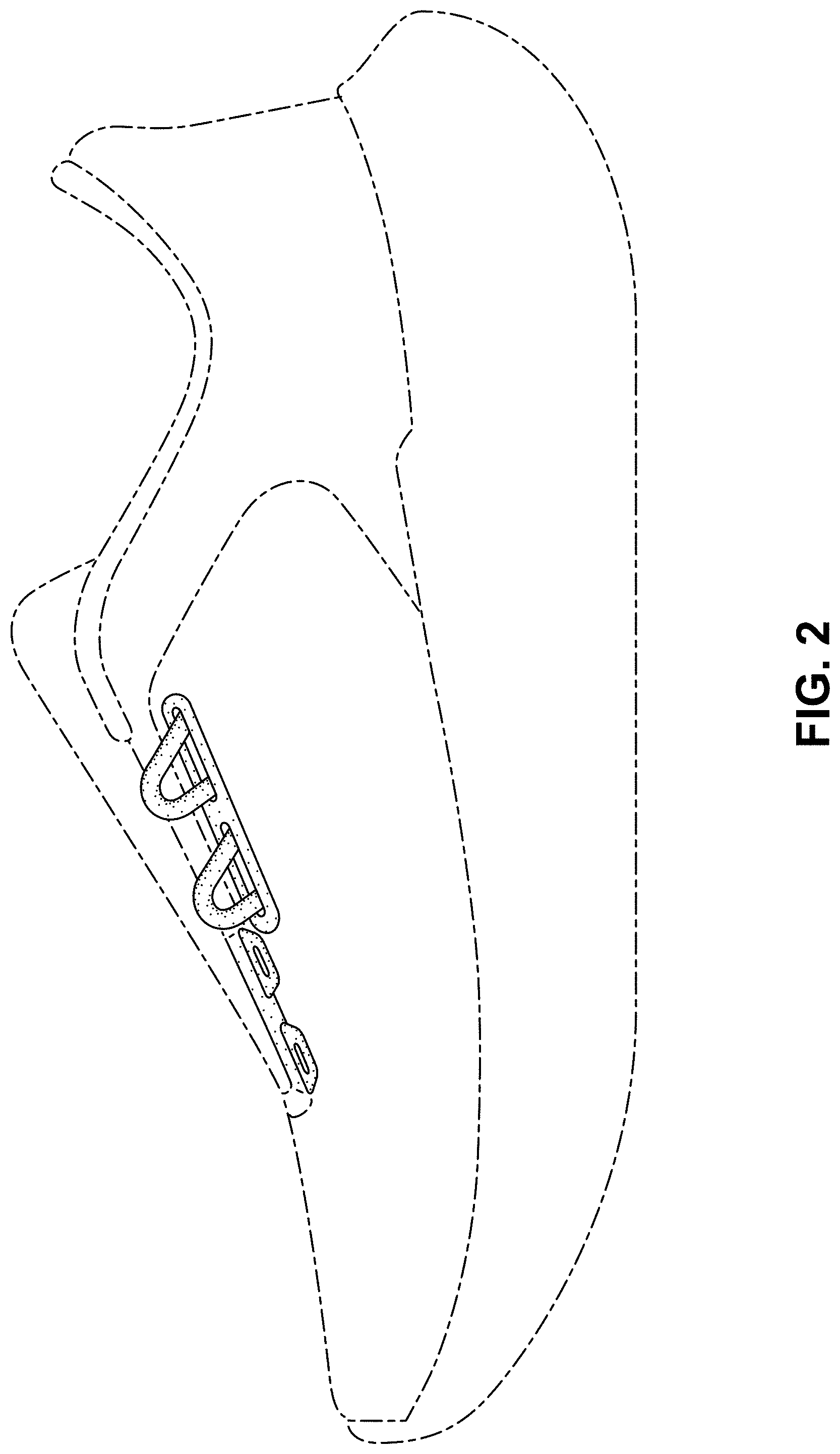 Patent USD0999512 Figure 2 – Shoe