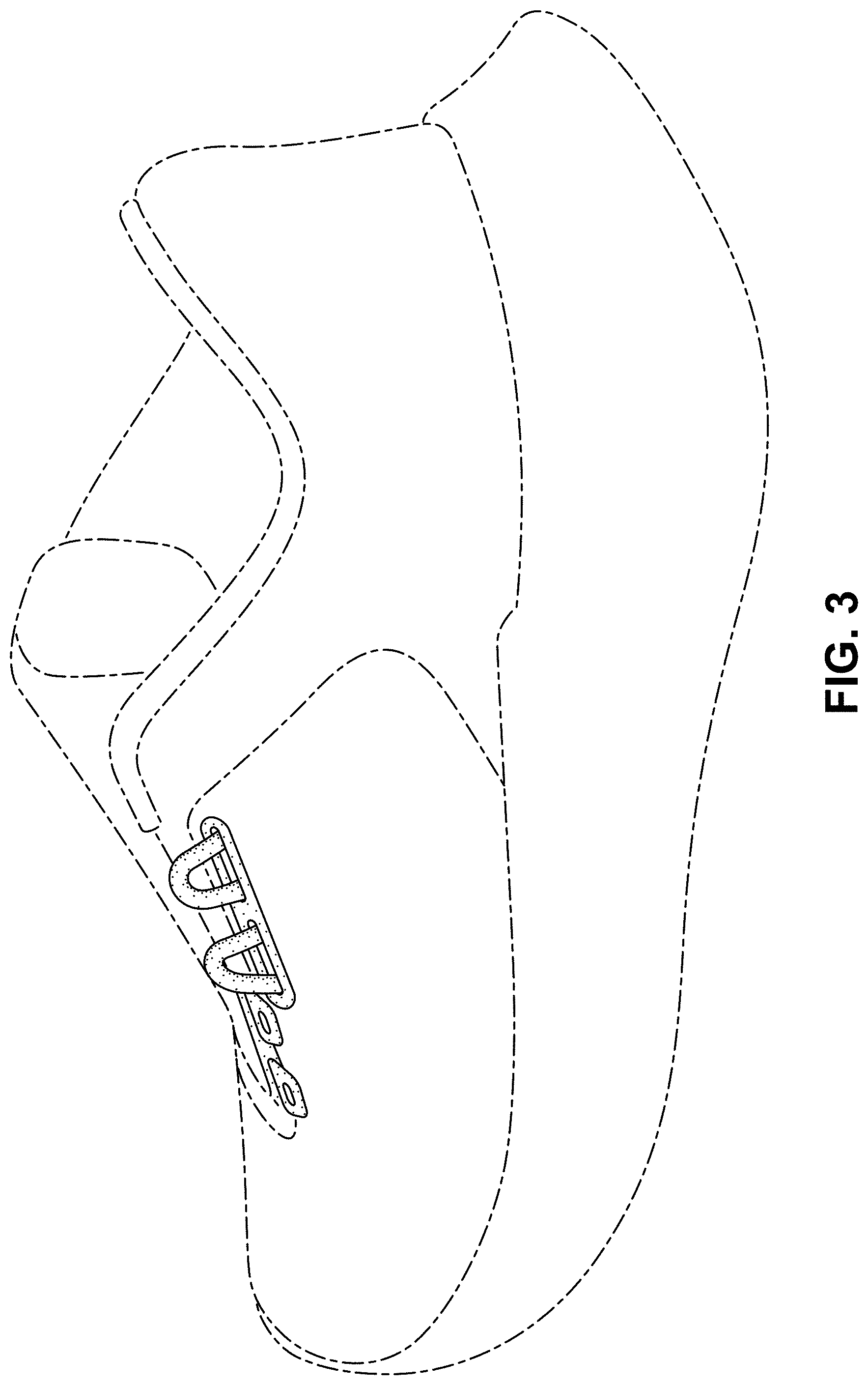 Patent USD0999512 Figure 3 – Shoe