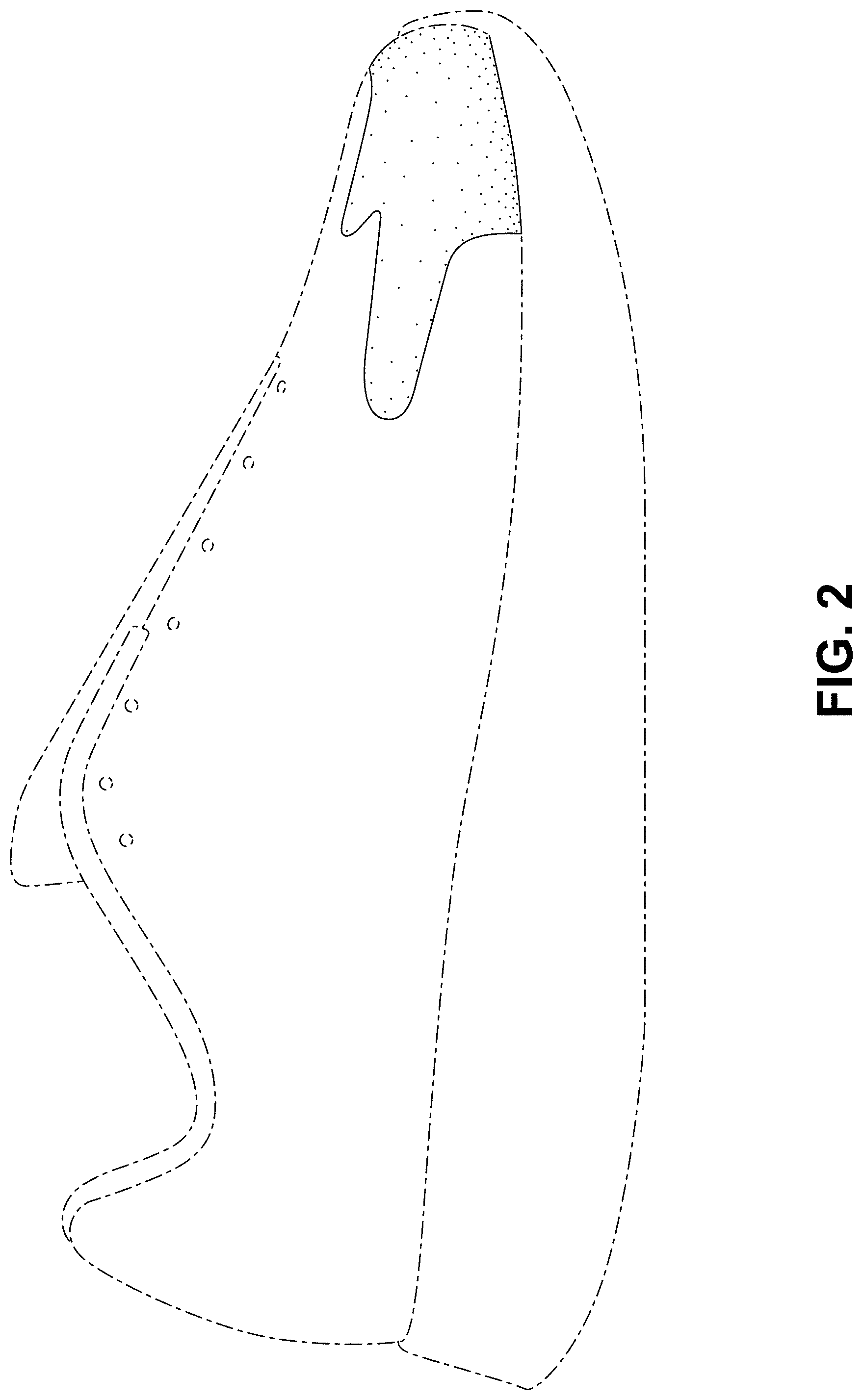 Patent USD1000048 Figure 2 – Shoe