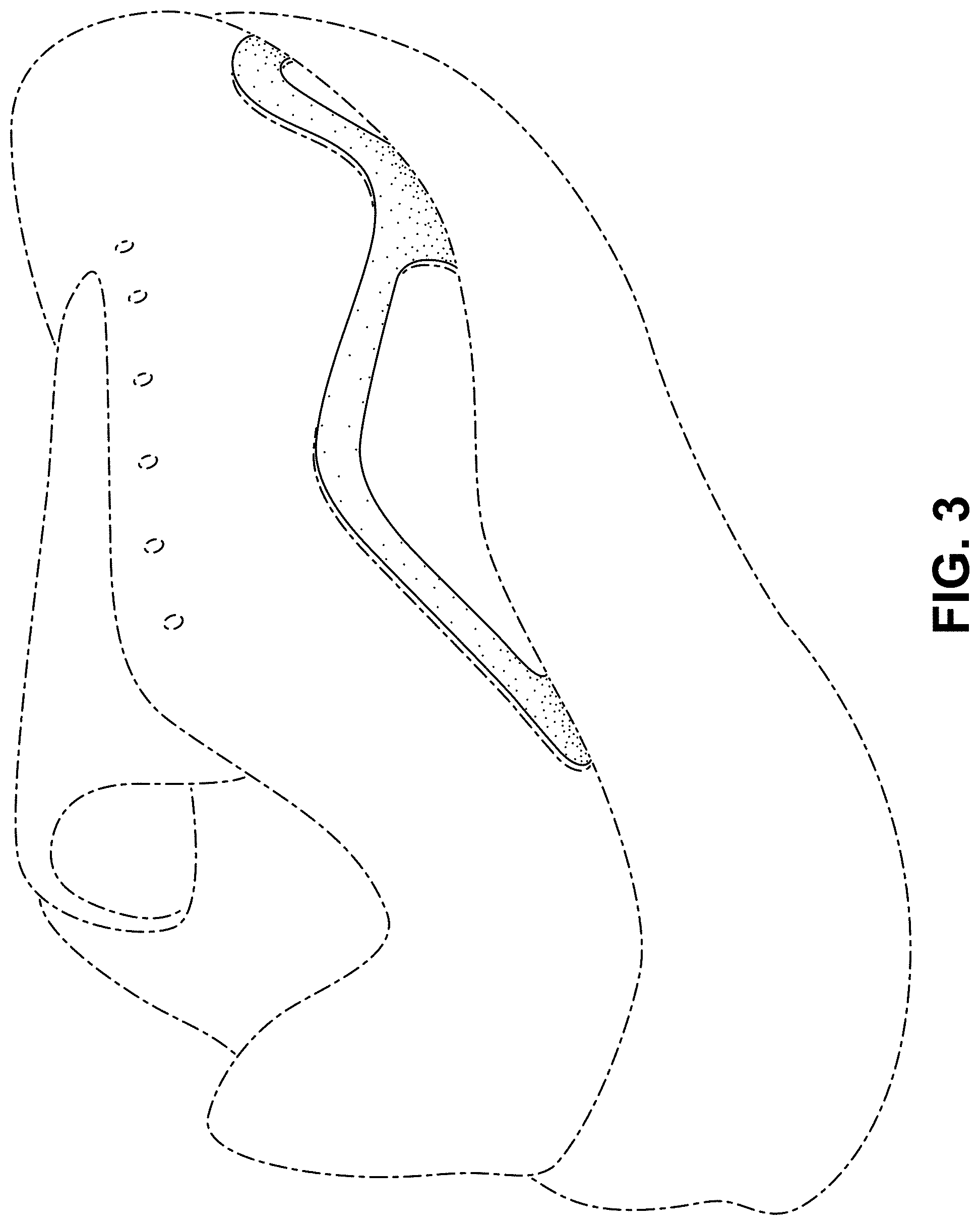 Patent USD1000049 Figure 3 – Shoe