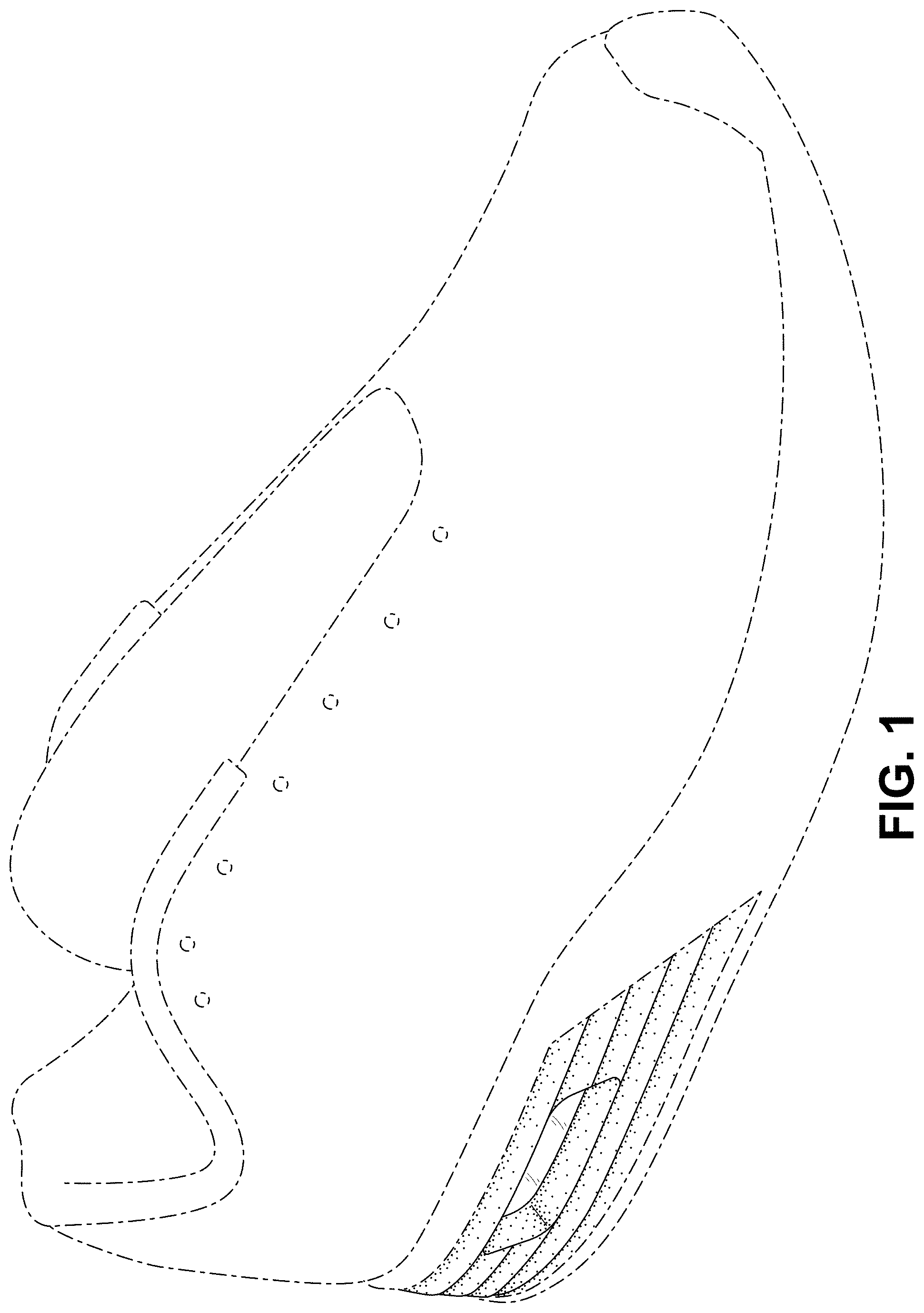 Patent USD1000069 Figure 1 – Shoe