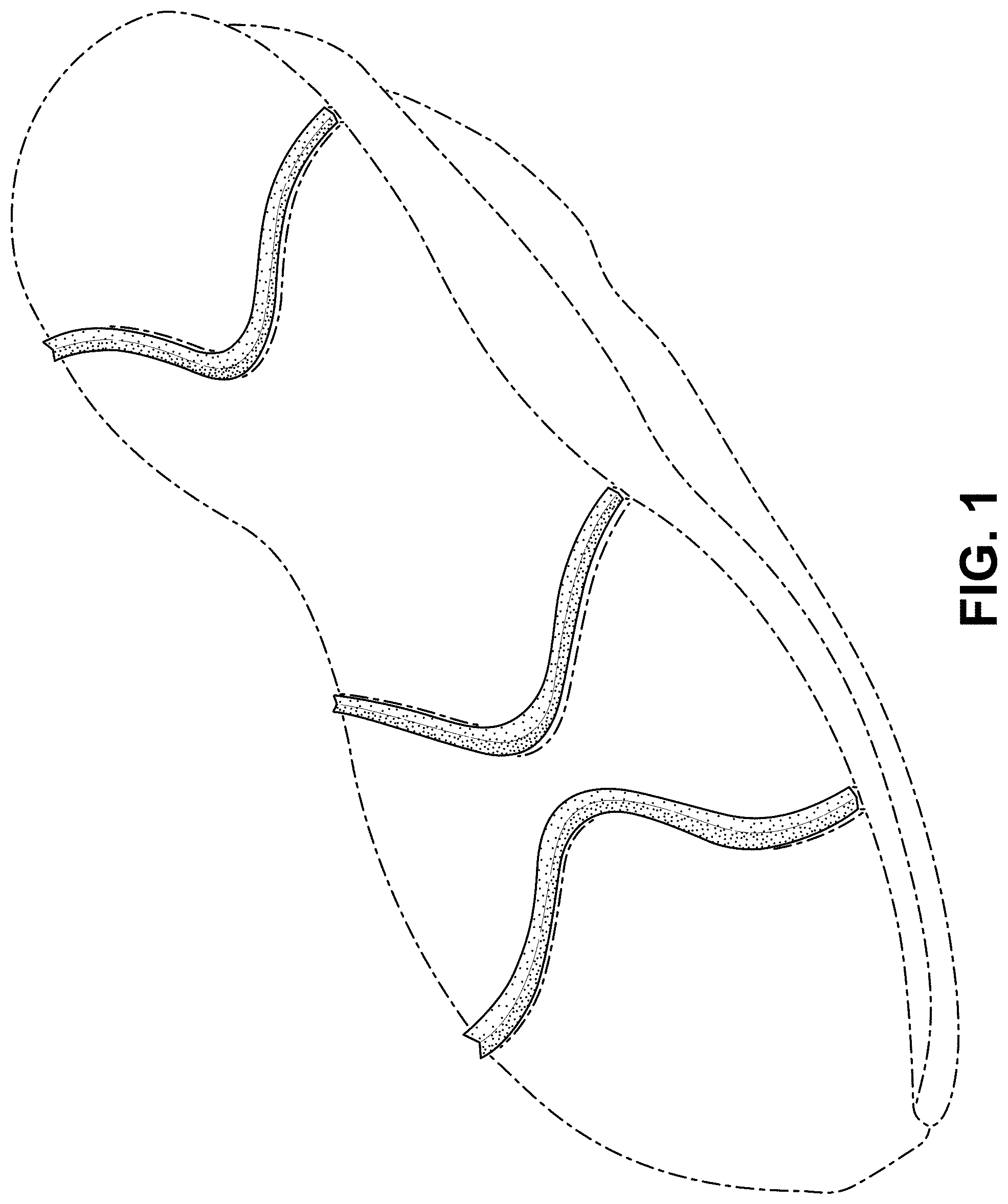Patent USD1000073 Figure 1 – Shoe