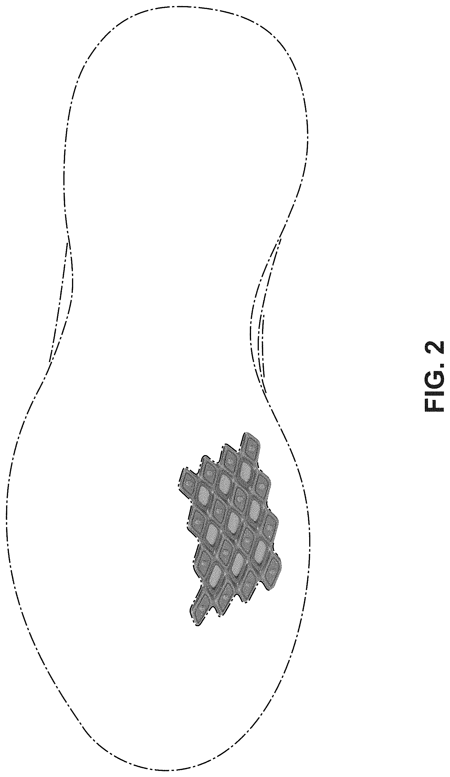 Patent USD1000077 Figure 2 – Shoe