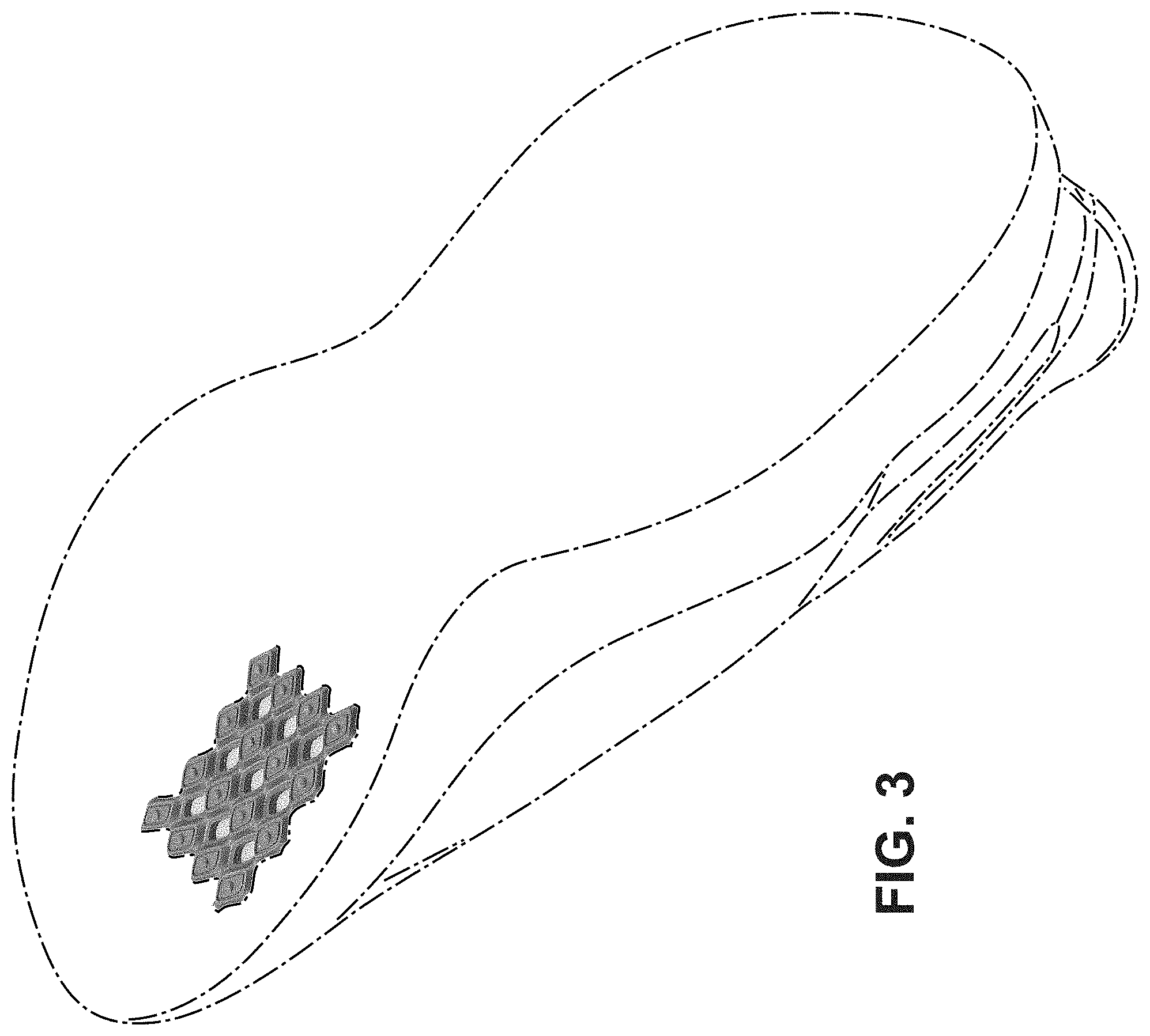 Patent USD1000077 Figure 3 – Shoe