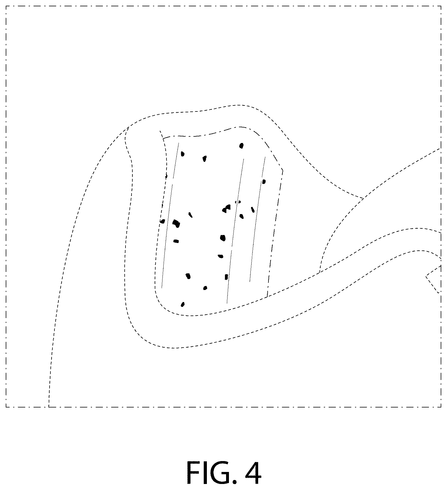 Patent USD1000084 Figure 4 – Shoe