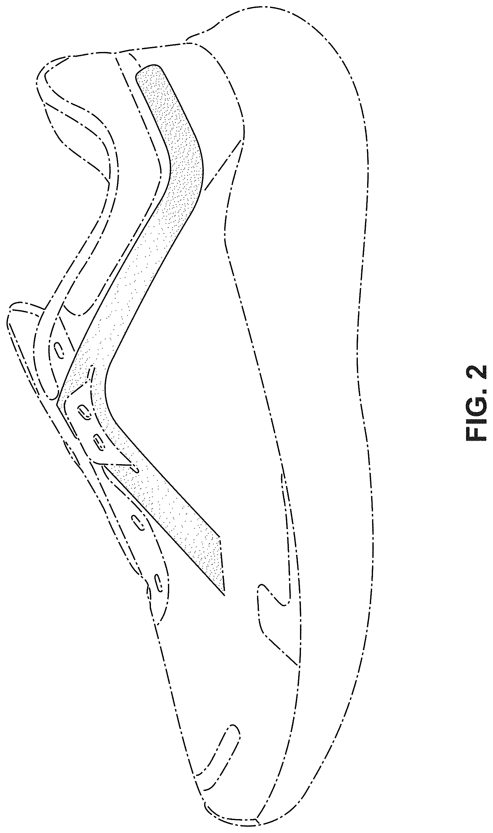 Patent USD1000086 Figure 2 – Shoe