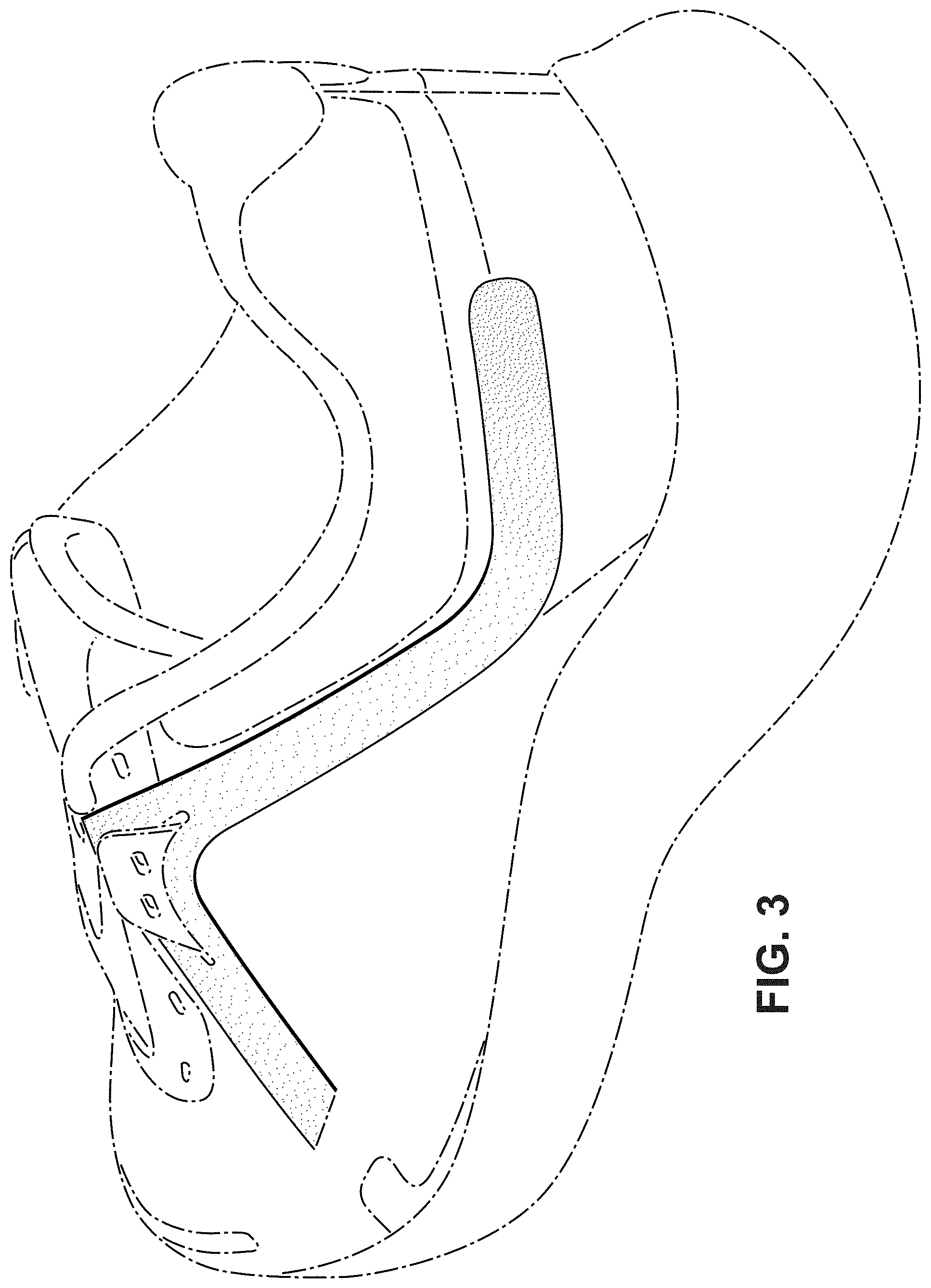 Patent USD1000086 Figure 3 – Shoe
