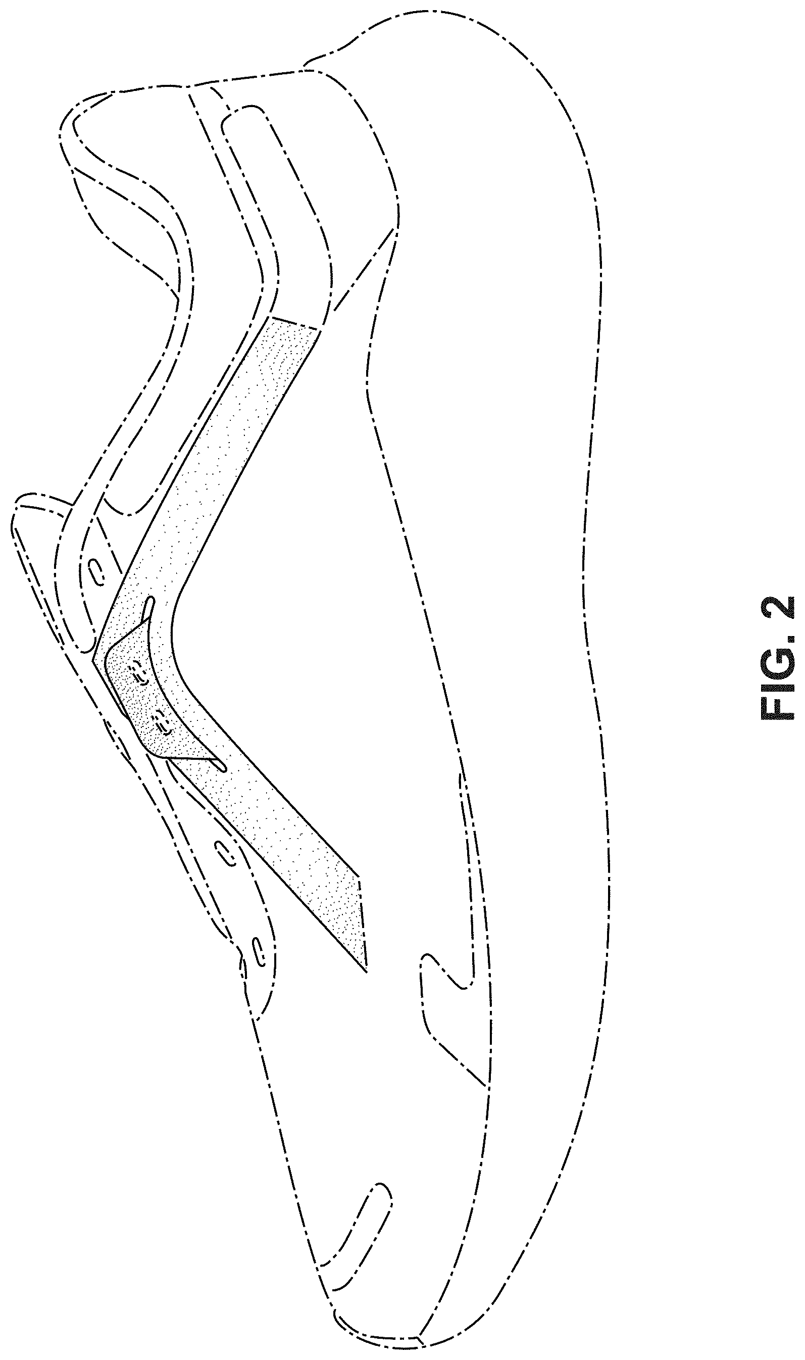 Patent USD1000087 Figure 2 – Shoe