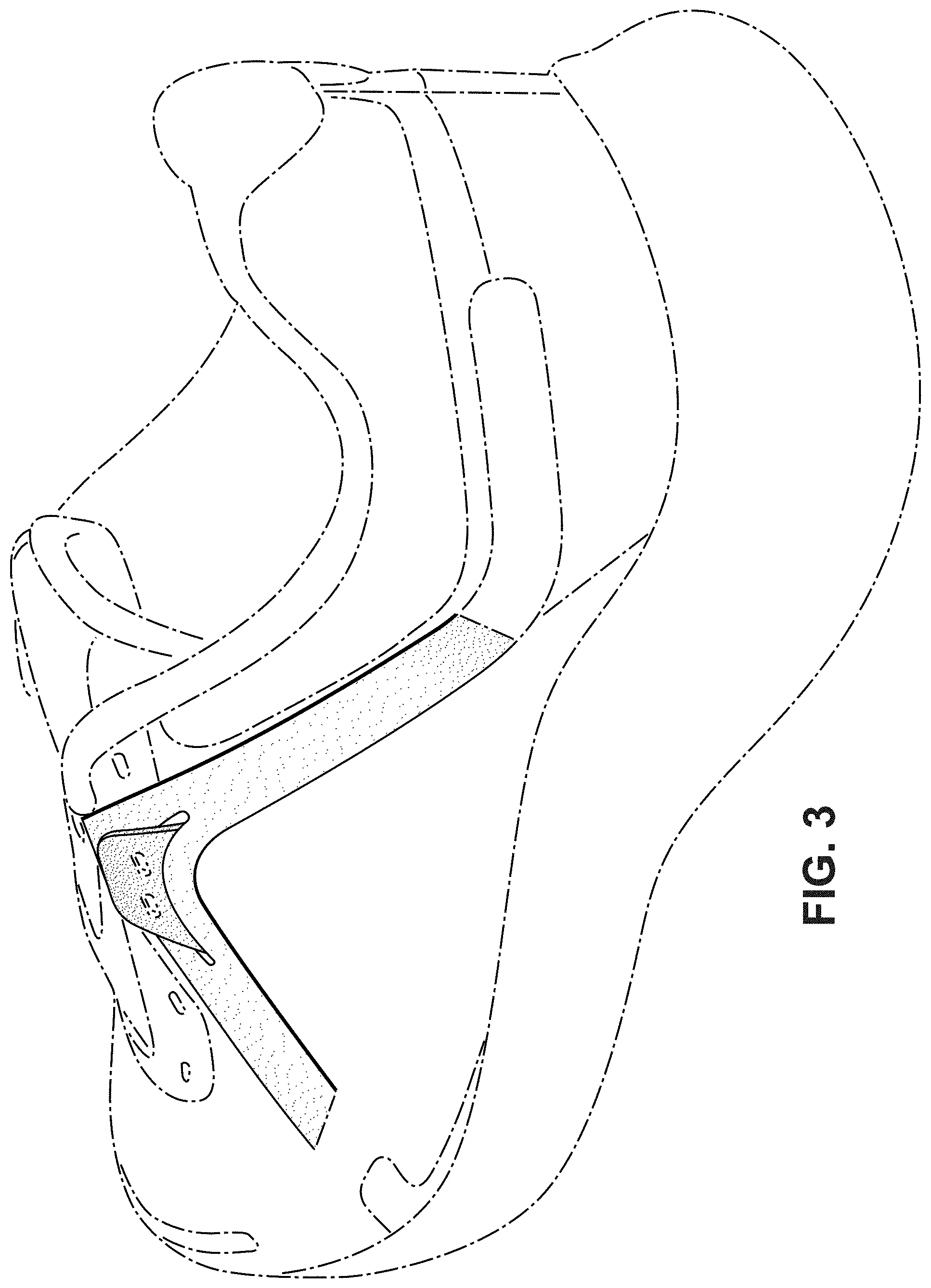 Patent USD1000087 Figure 3 – Shoe