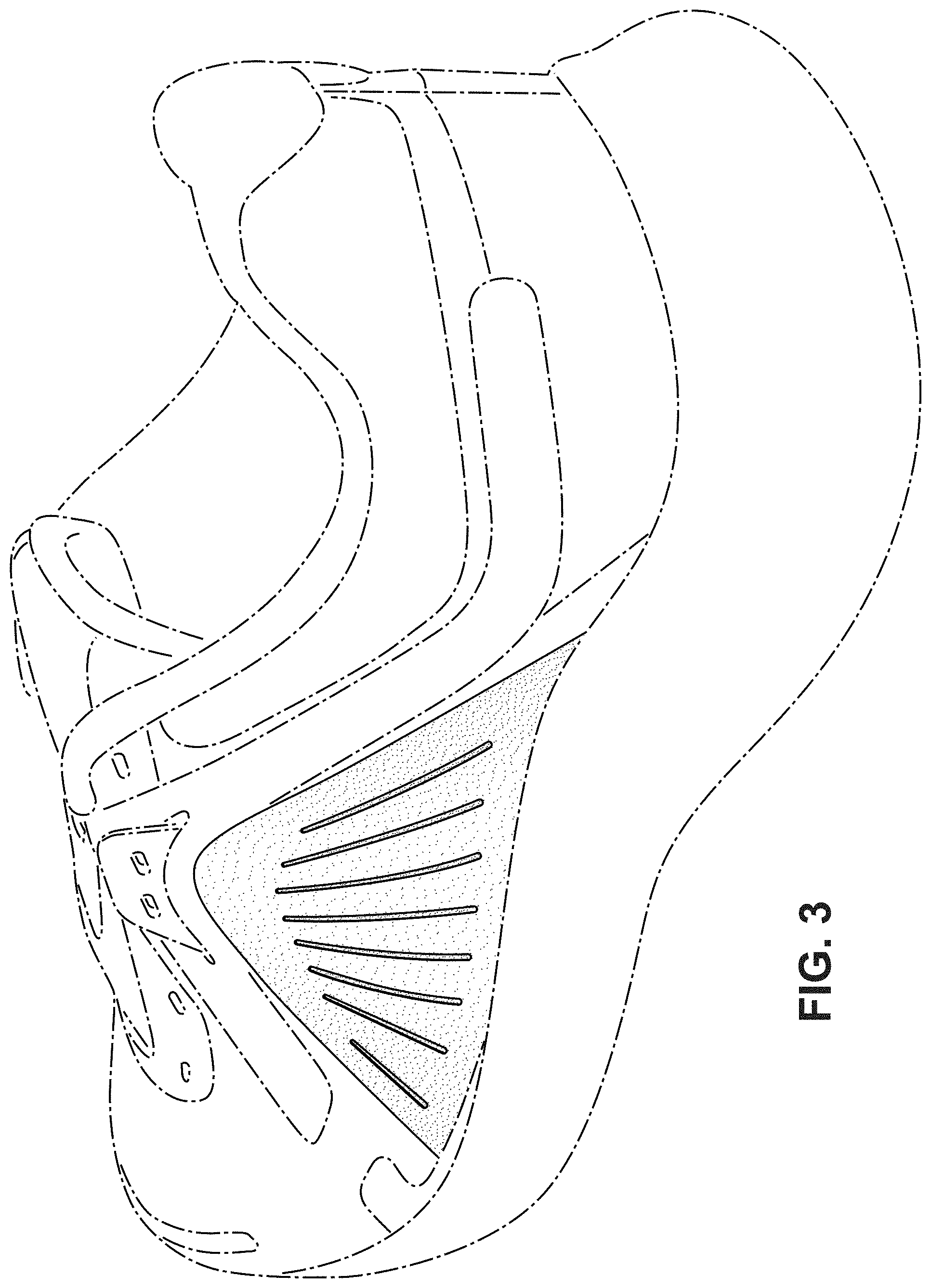 Patent USD1000088 Figure 3 – Shoe