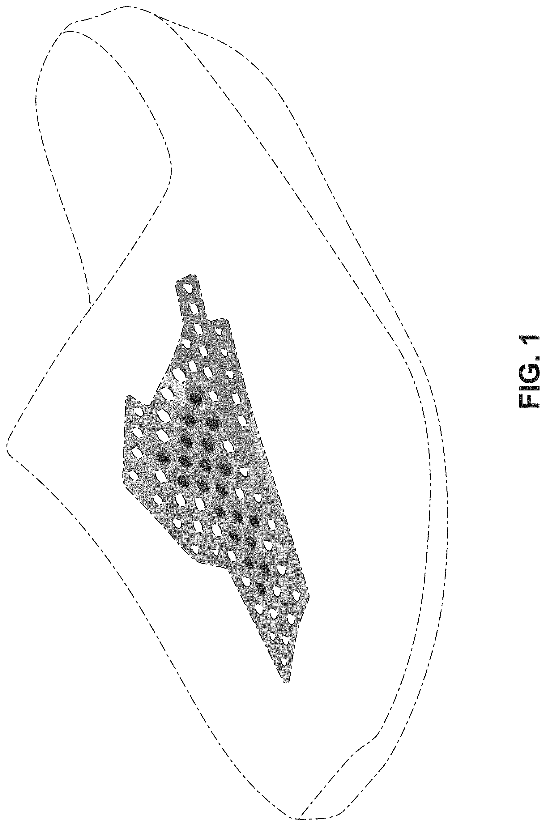 Patent USD1000091 Figure 1 – Shoe