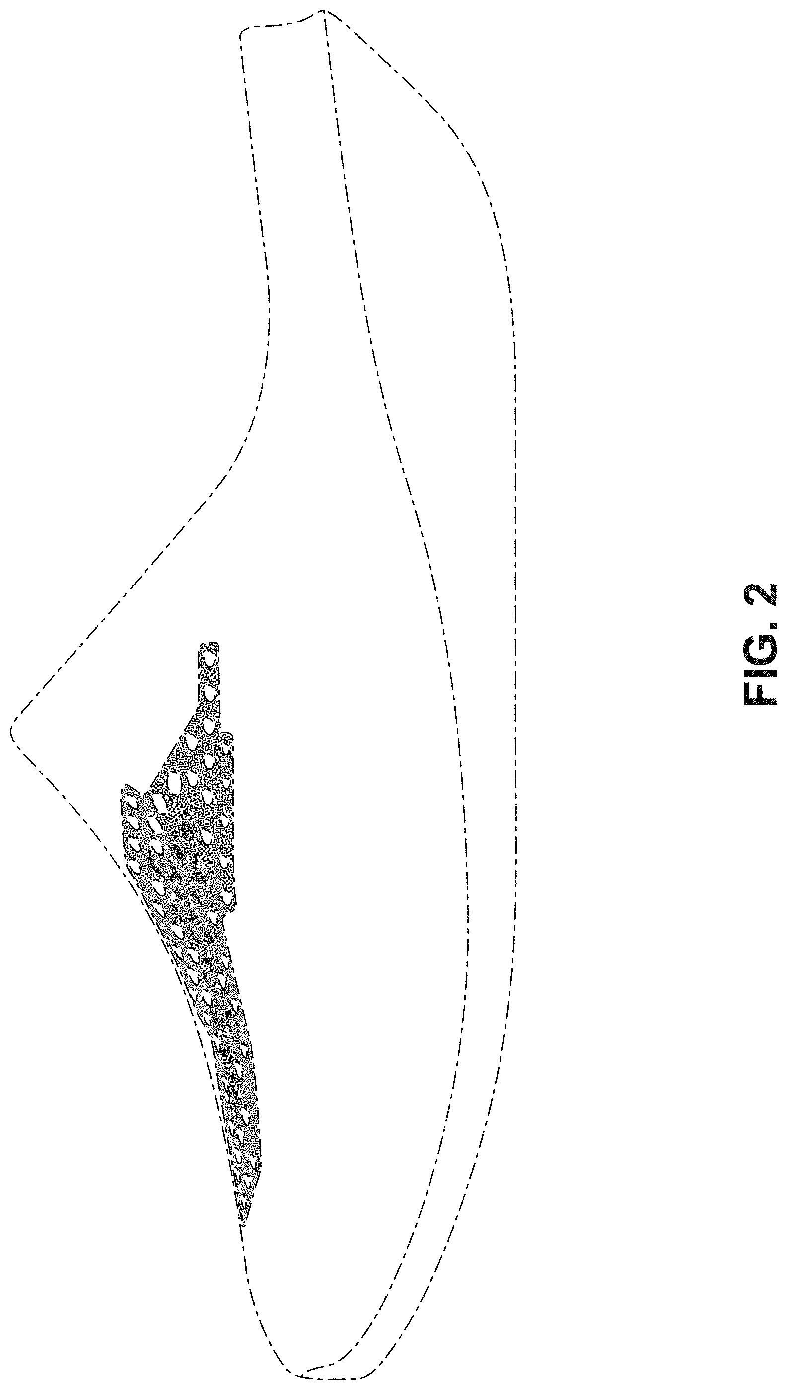Patent USD1000091 Figure 2 – Shoe