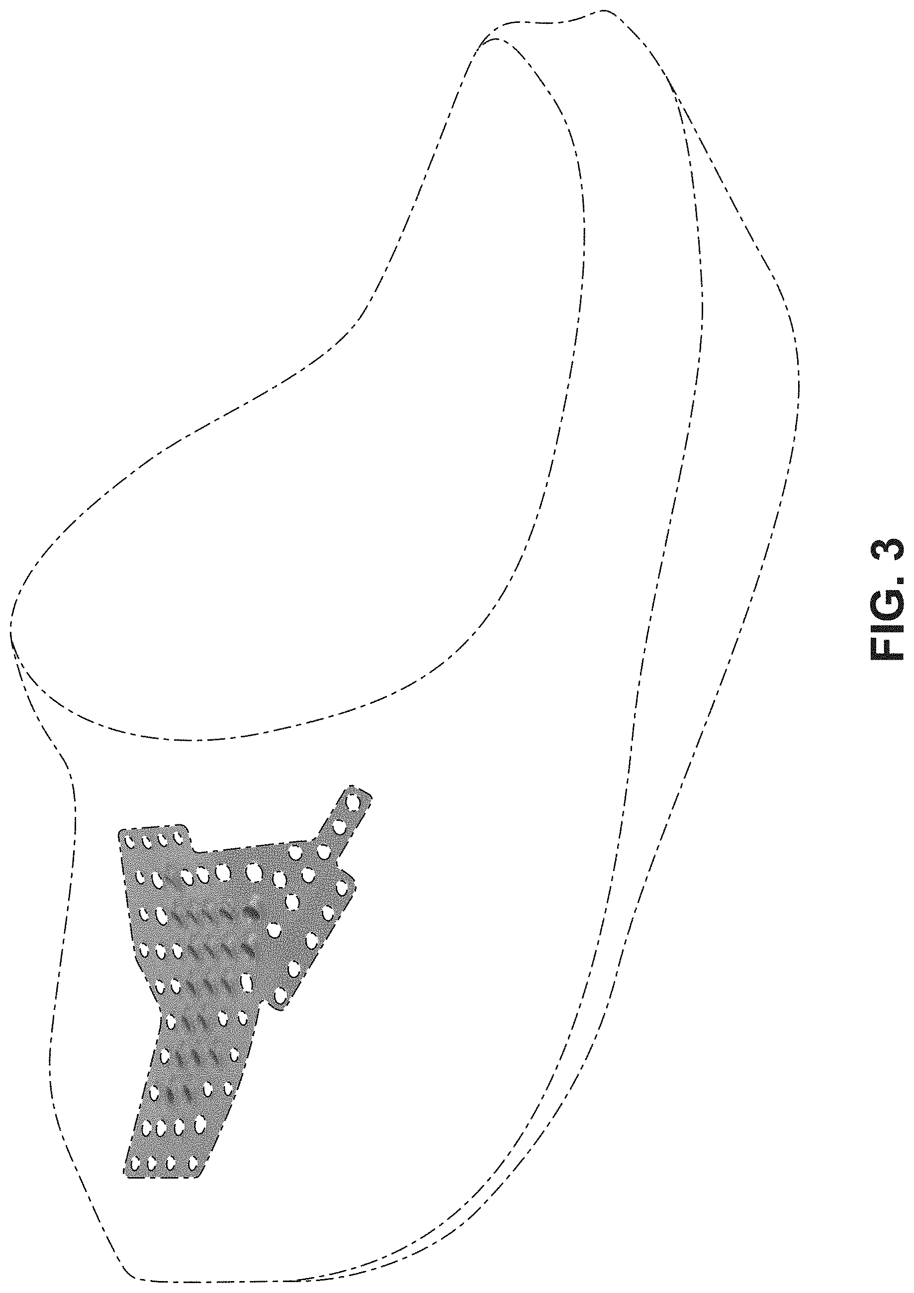Patent USD1000091 Figure 3 – Shoe