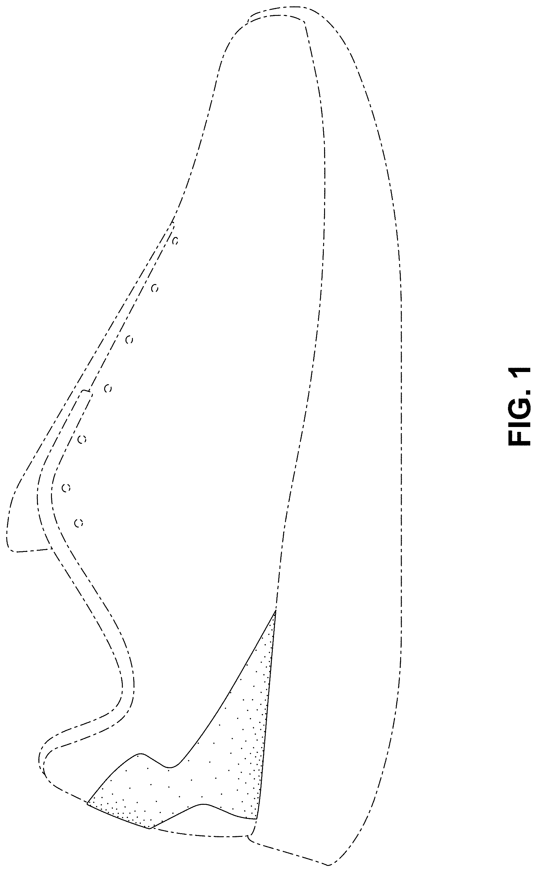 Patent USD1000093 Figure 1 – Shoe