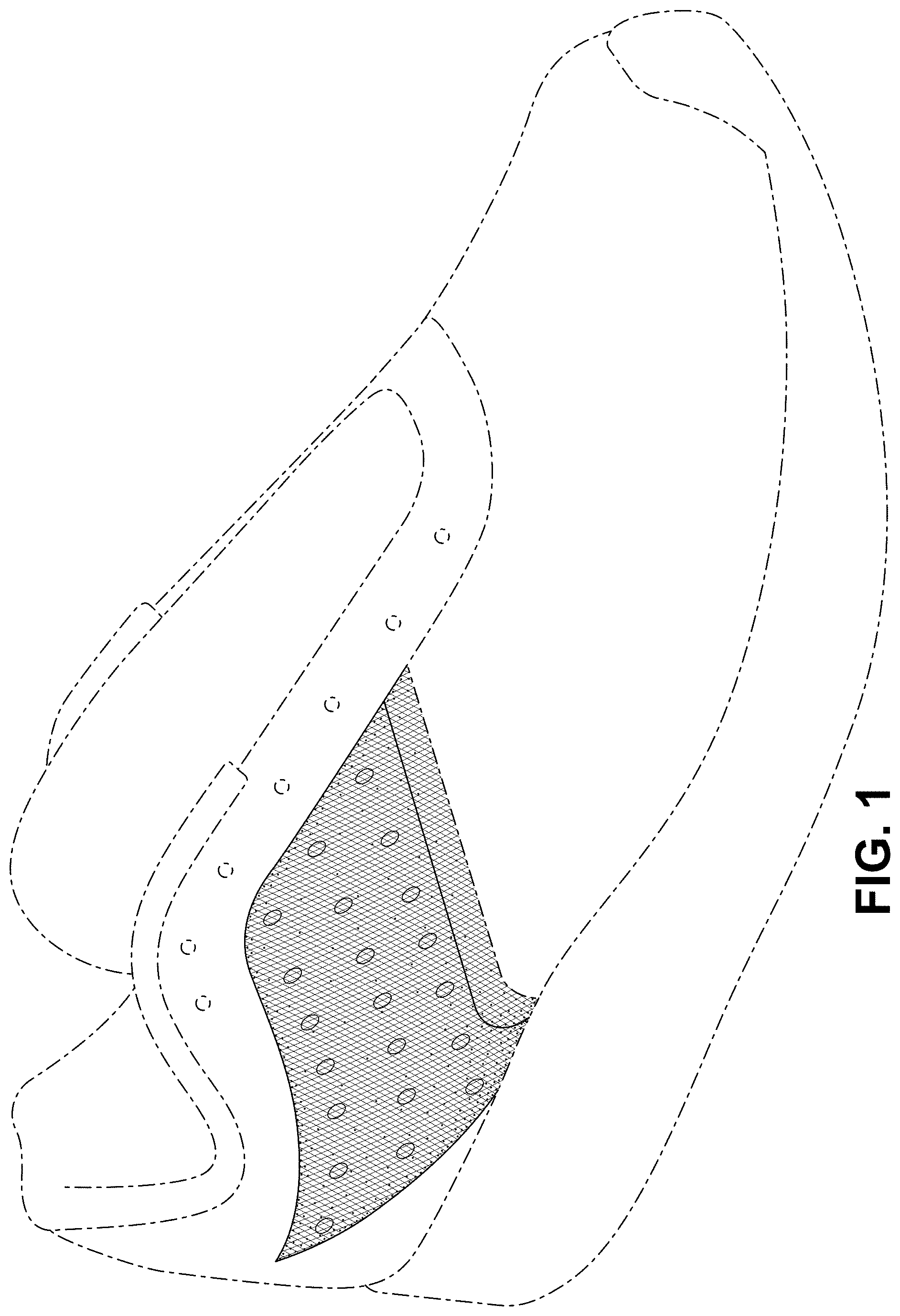 Patent USD1000094 Figure 1 – Shoe