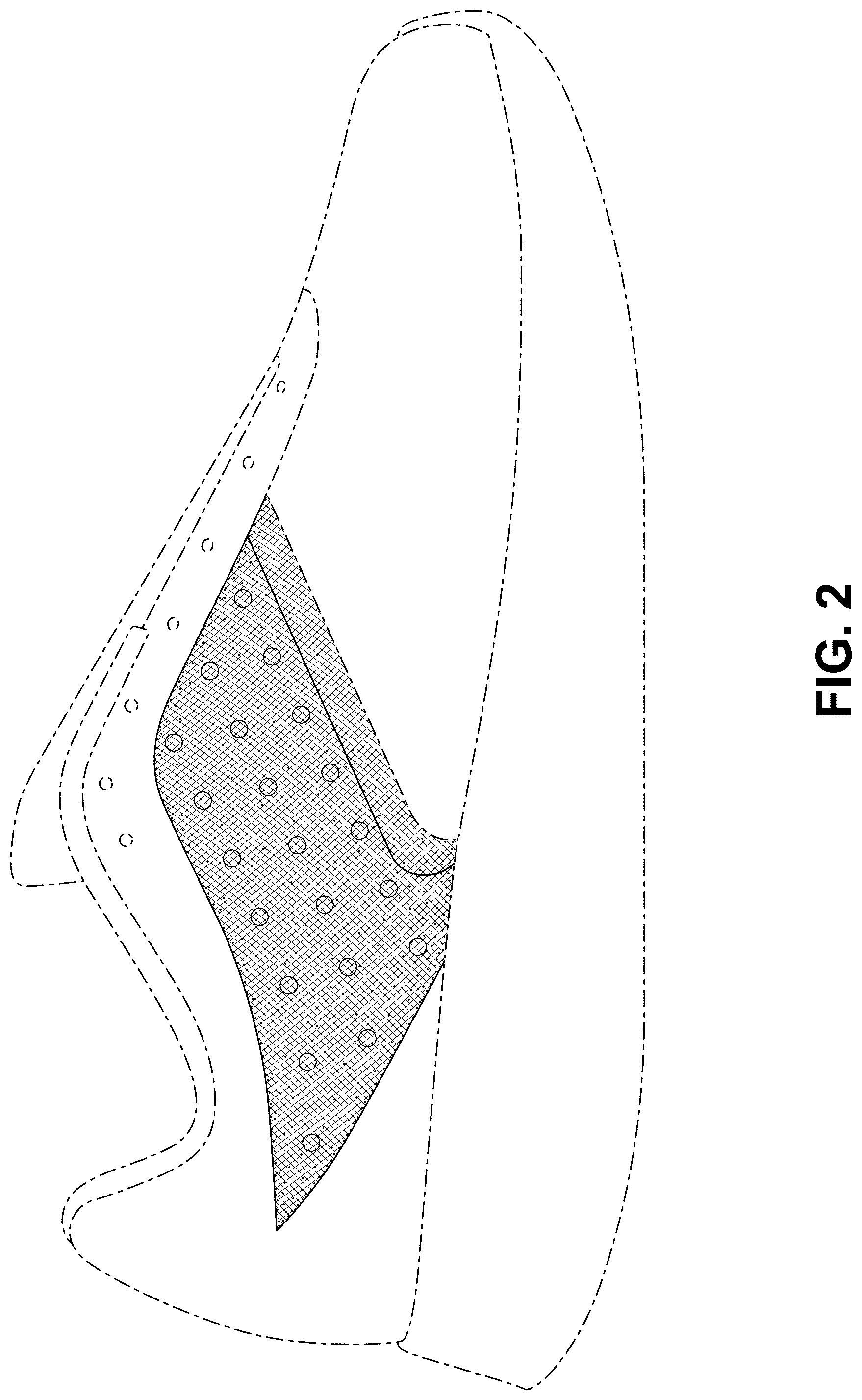 Patent USD1000094 Figure 2 – Shoe
