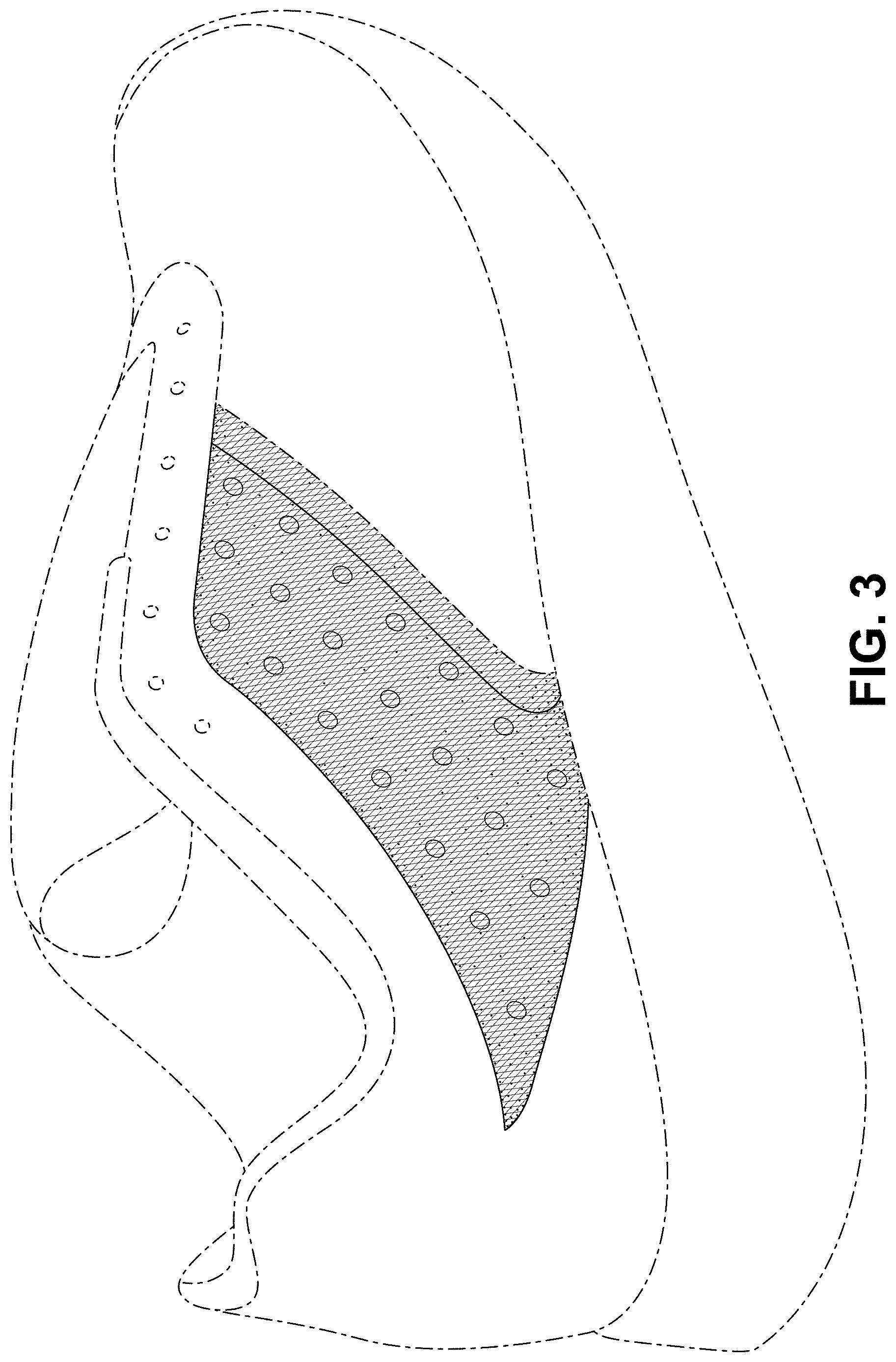 Patent USD1000094 Figure 3 – Shoe