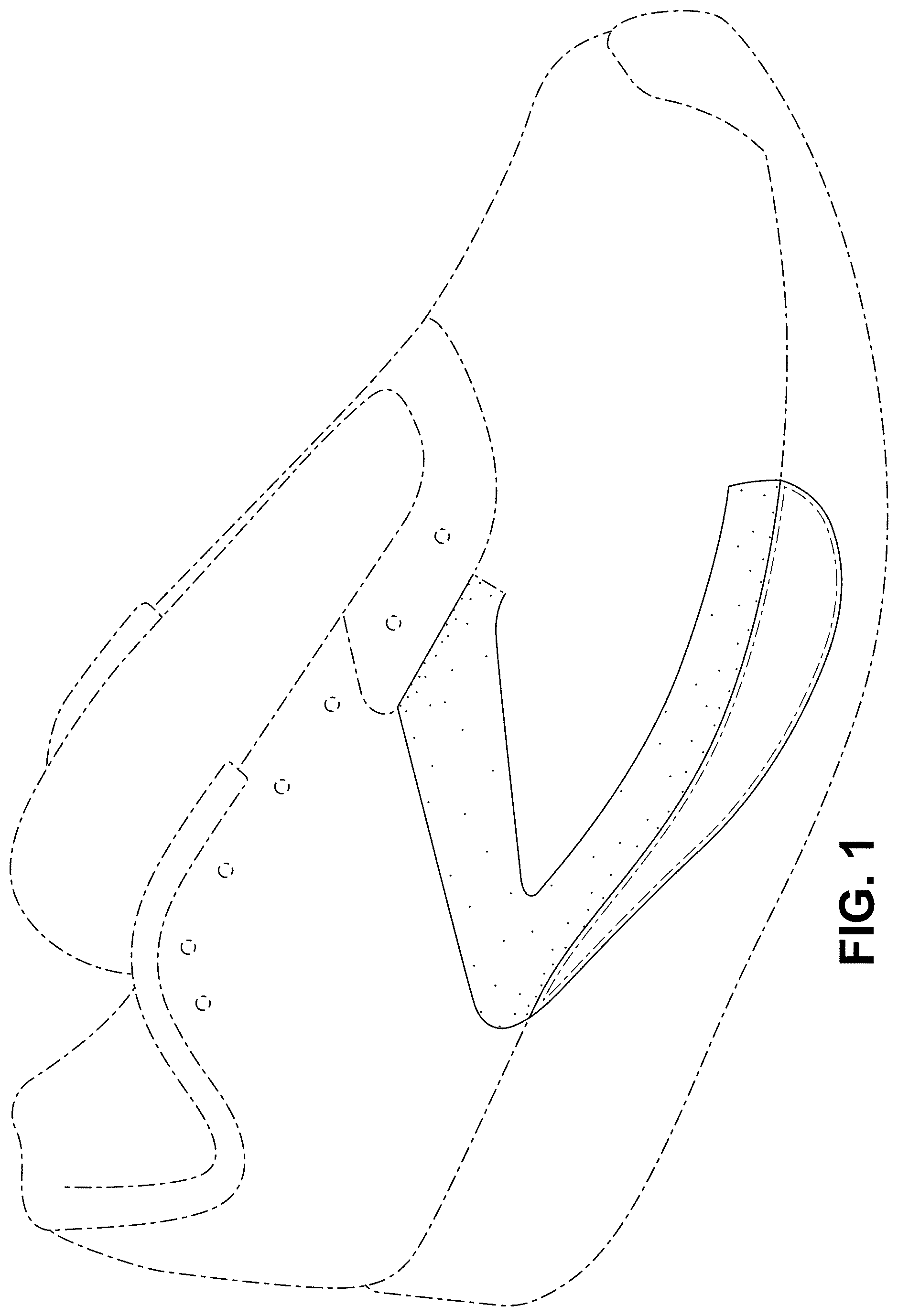 Patent USD1000095 Figure 1 – Shoe