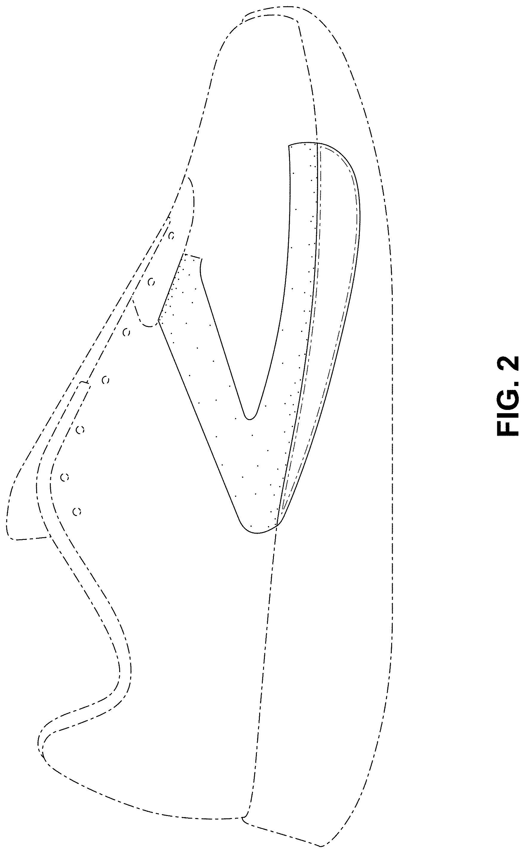 Patent USD1000095 Figure 2 – Shoe