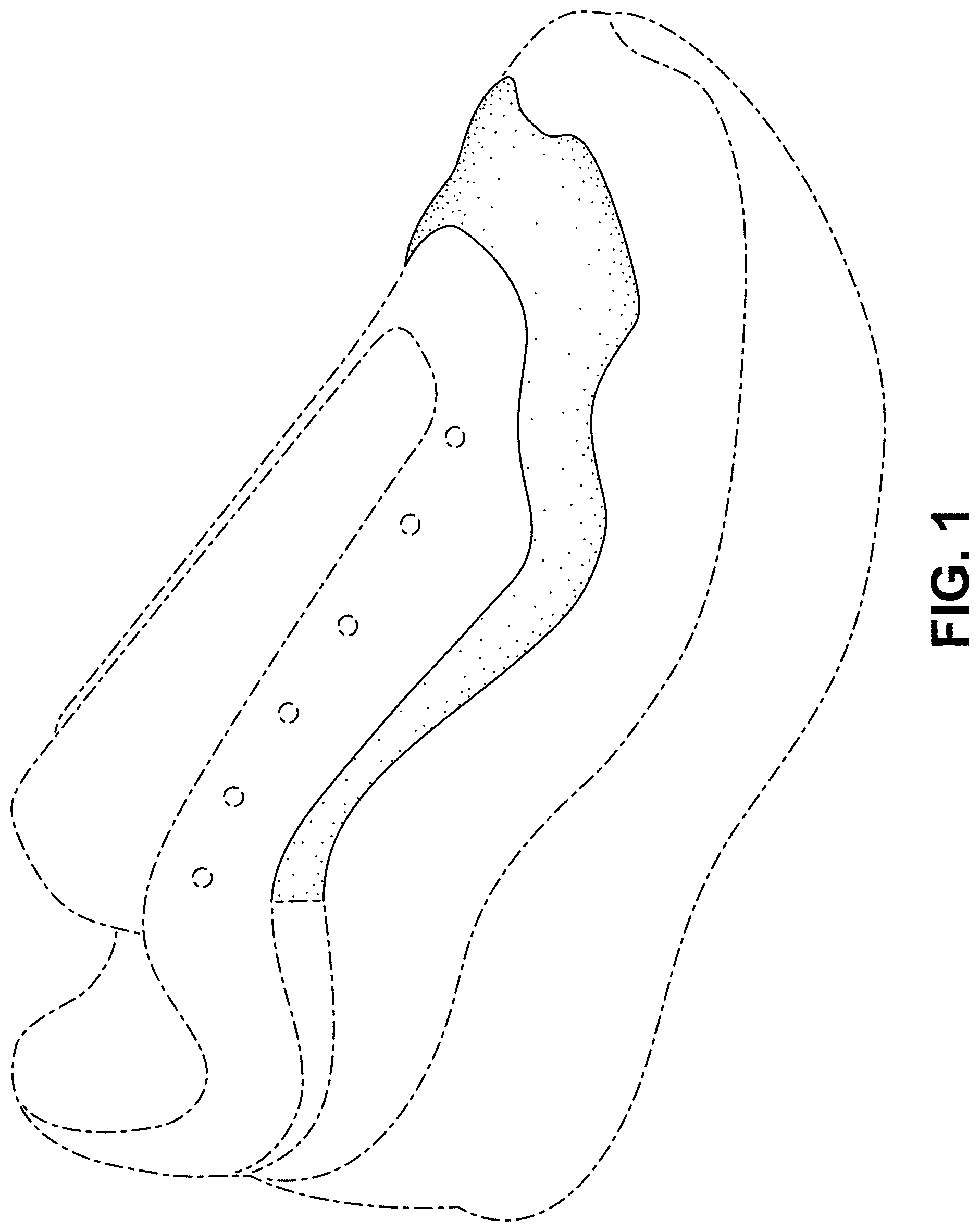 Patent USD1000096 Figure 1 – Shoe
