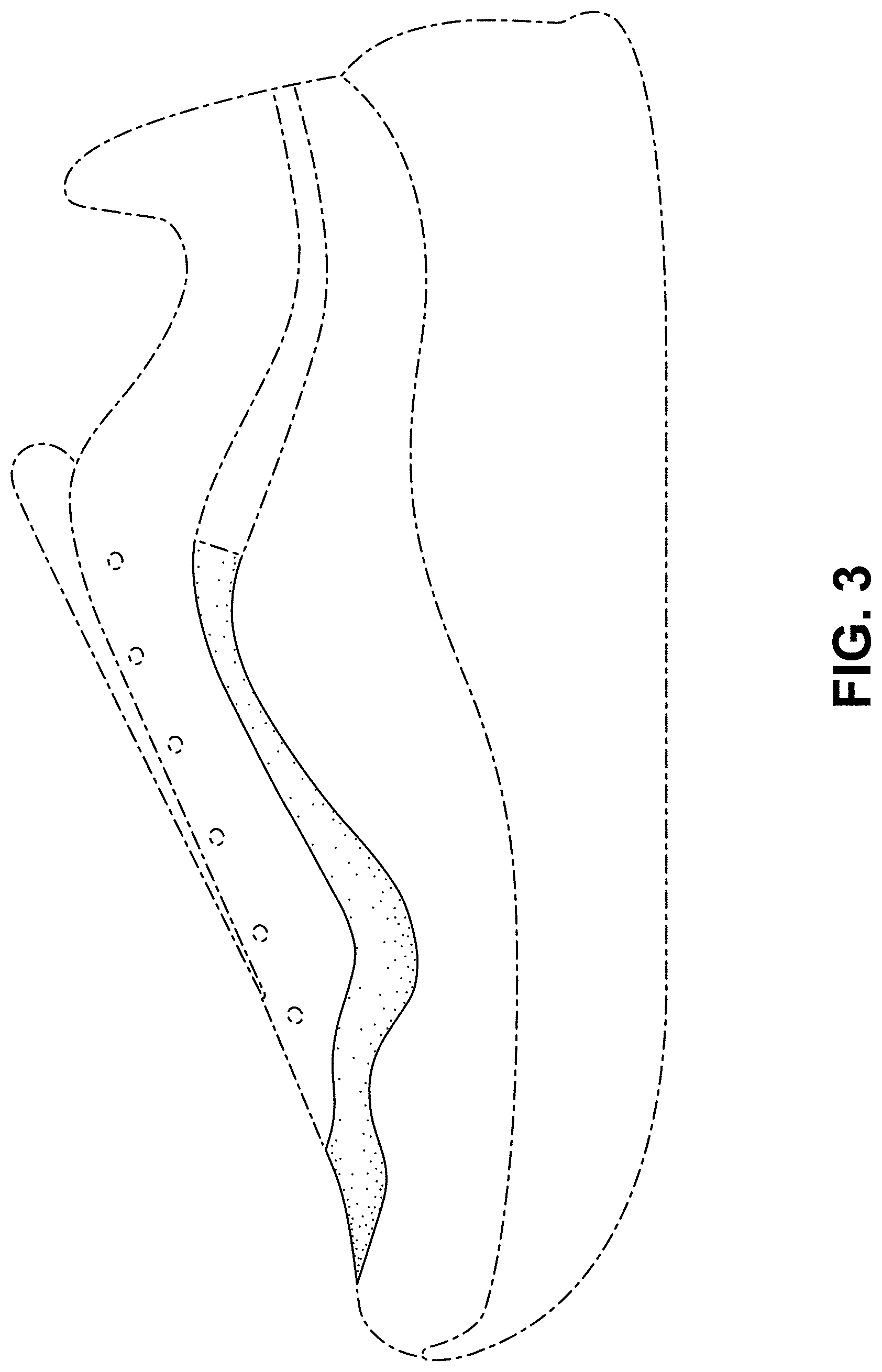 Patent USD1000096 Figure 3 – Shoe