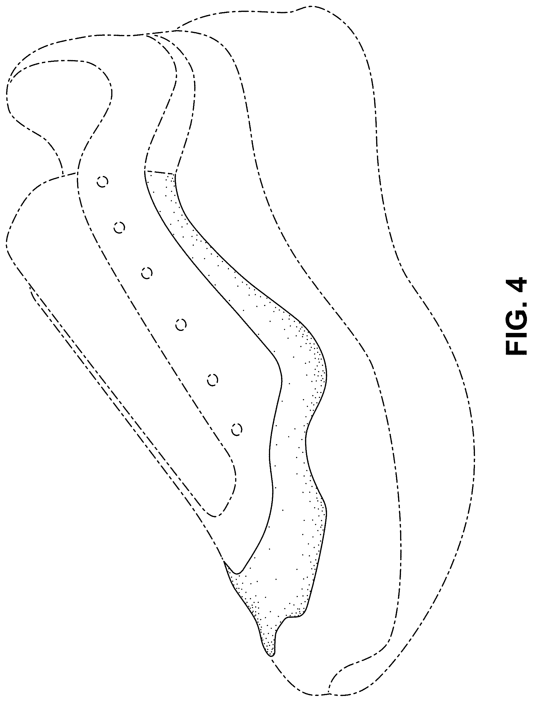Patent USD1000096 Figure 4 – Shoe