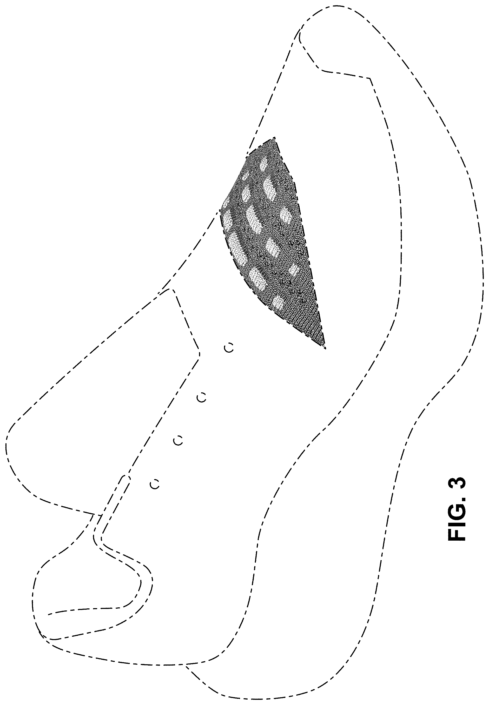 Patent USD1000098 Figure 3 – Shoe