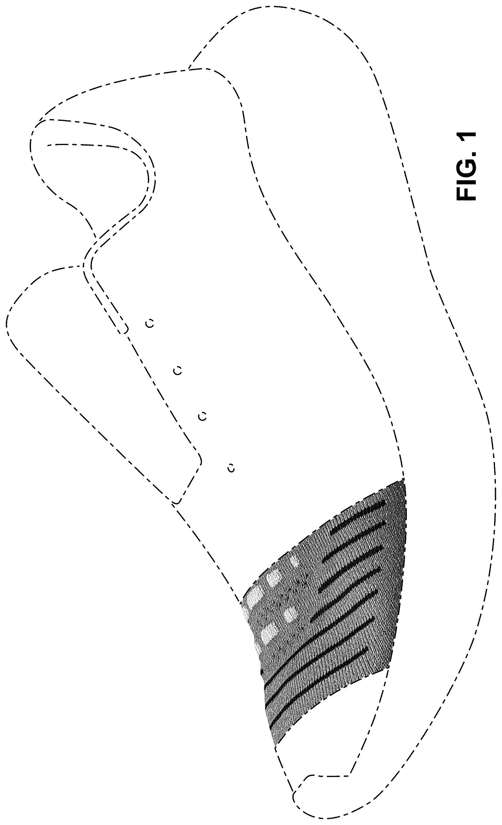 Patent USD1000099 Figure 1 – Shoe