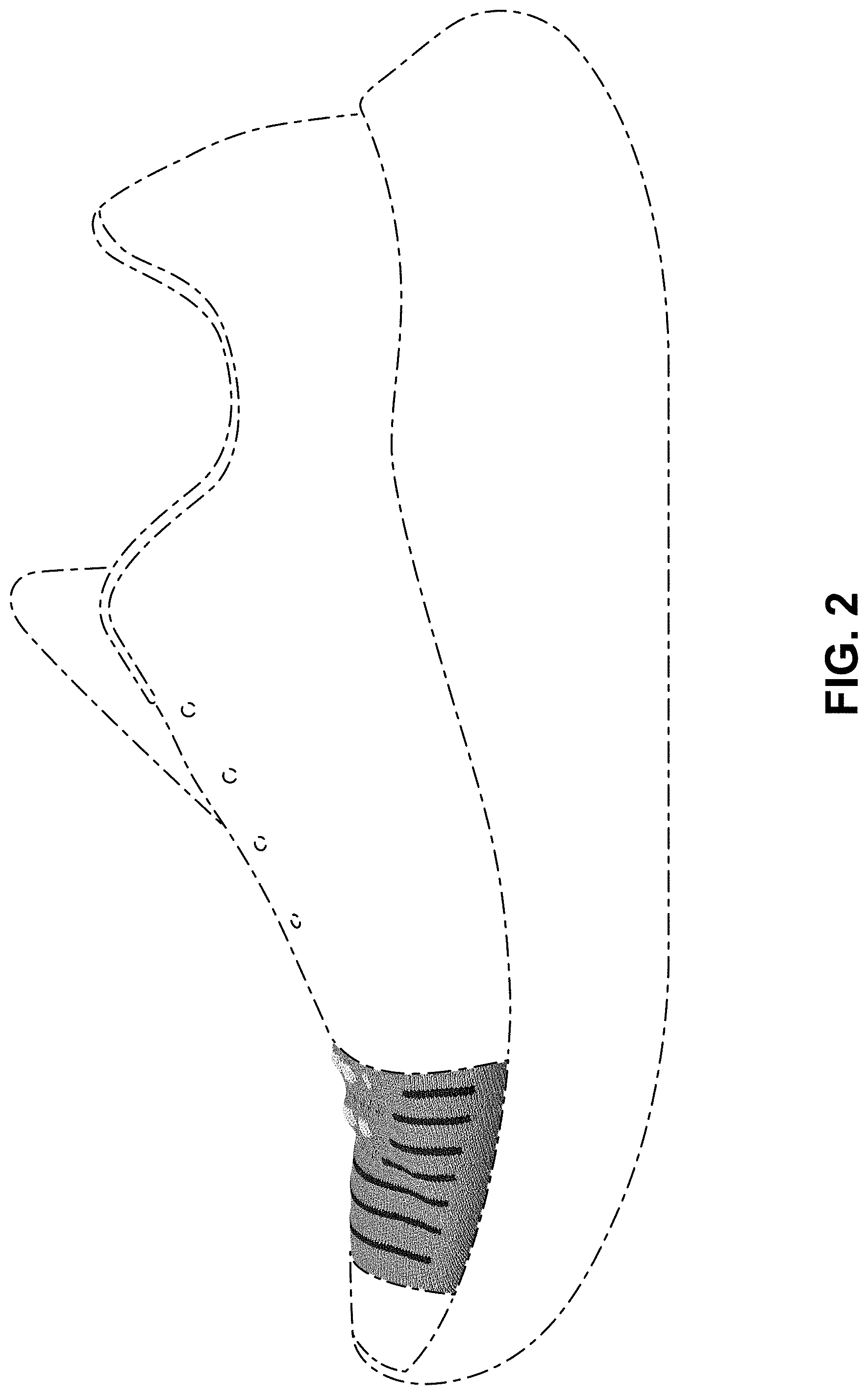 Patent USD1000099 Figure 2 – Shoe