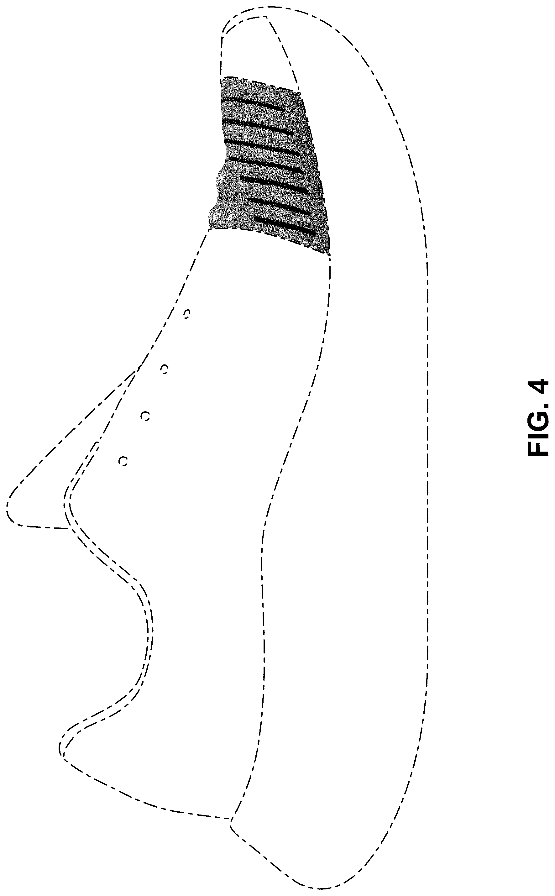 Patent USD1000099 Figure 4 – Shoe