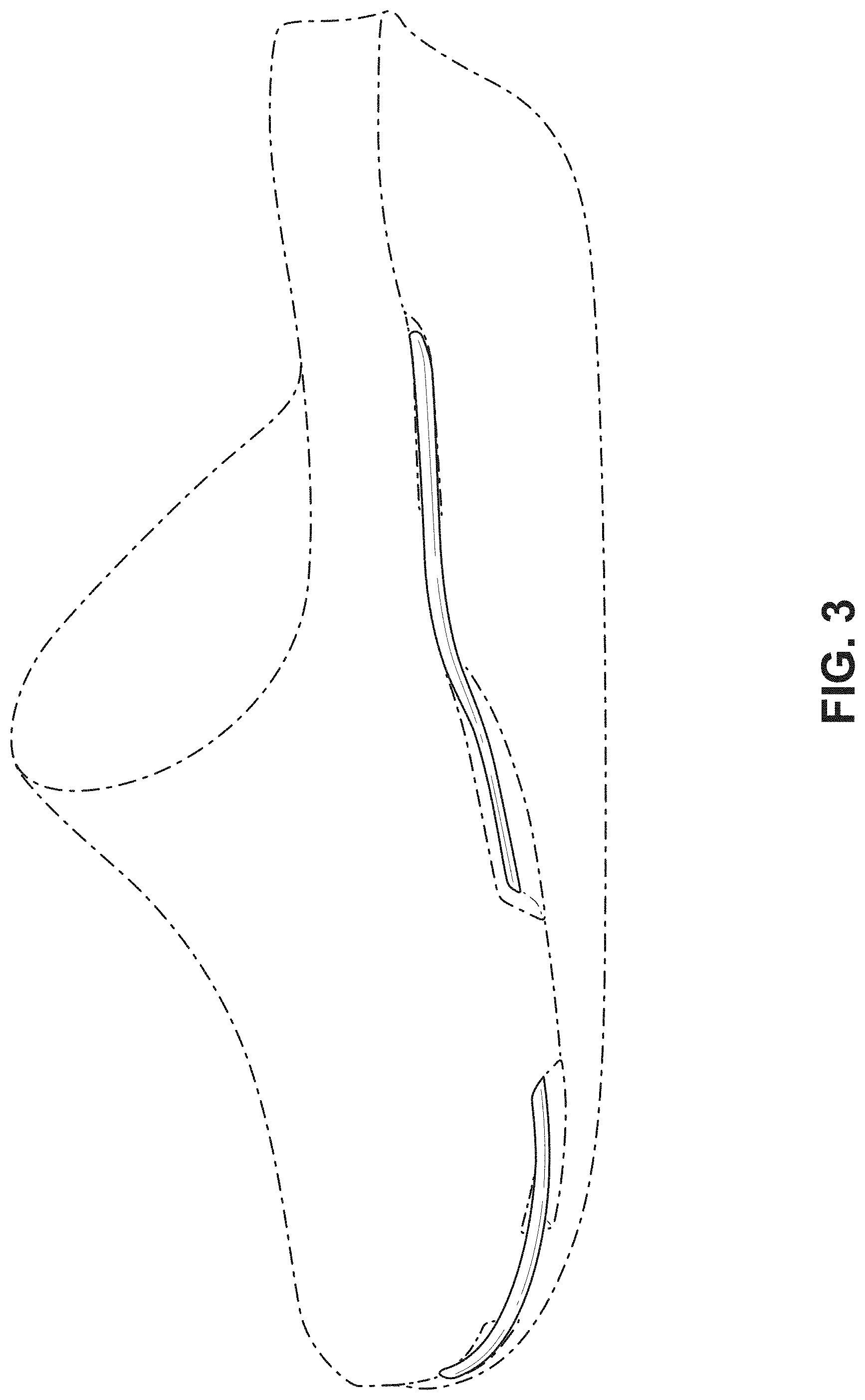 Patent USD1000100 Figure 3 – Shoe