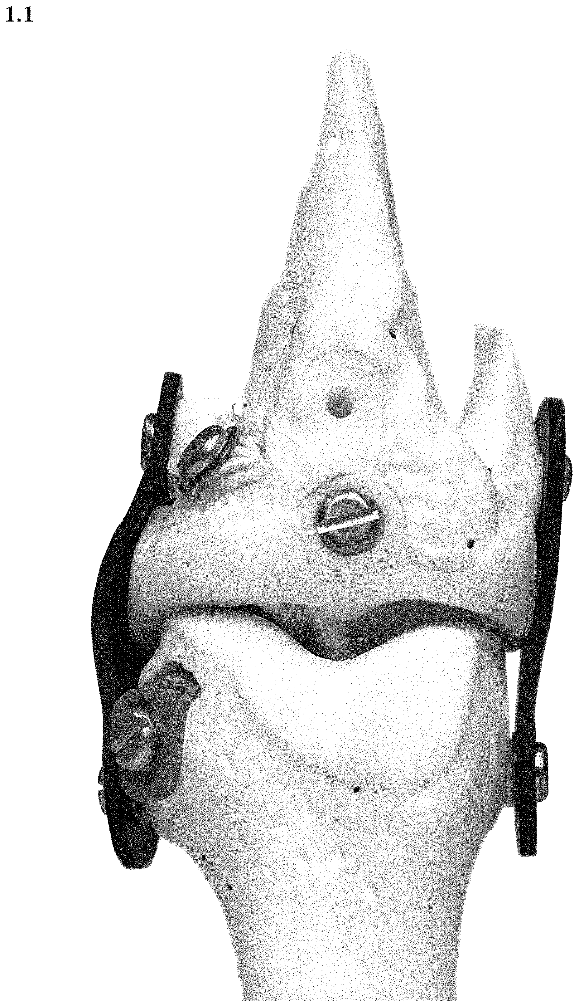 Patent USD1000614 Figure 1 – Artificial knee prosthetics