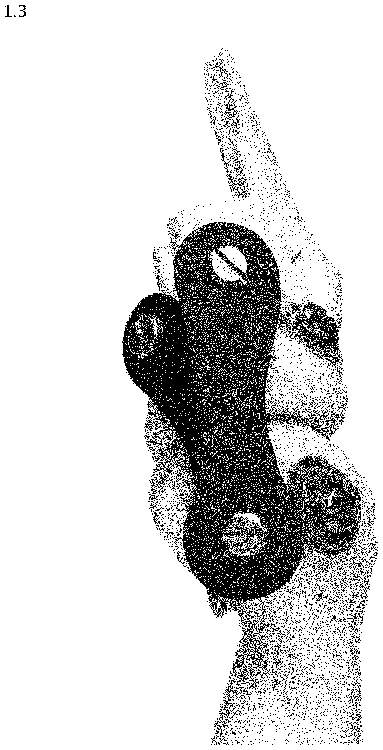 Patent USD1000614 Figure 3 – Artificial knee prosthetics
