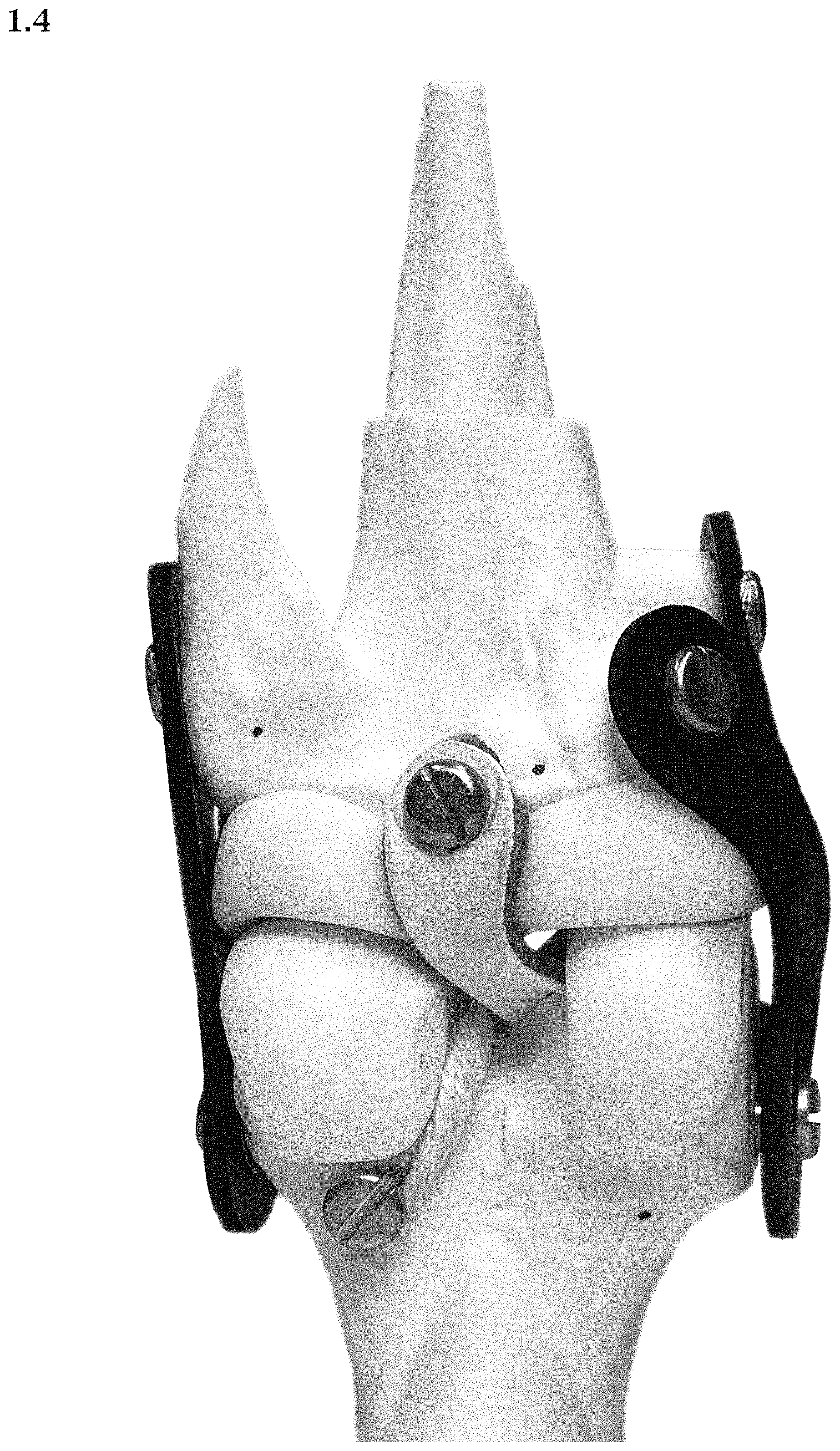 Patent USD1000614 Figure 4 – Artificial knee prosthetics