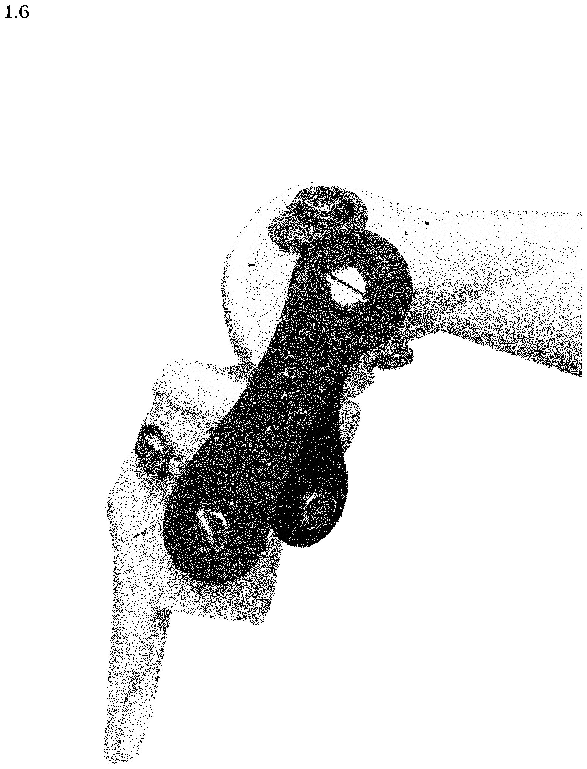 Patent USD1000614 Figure 6 – Artificial knee prosthetics