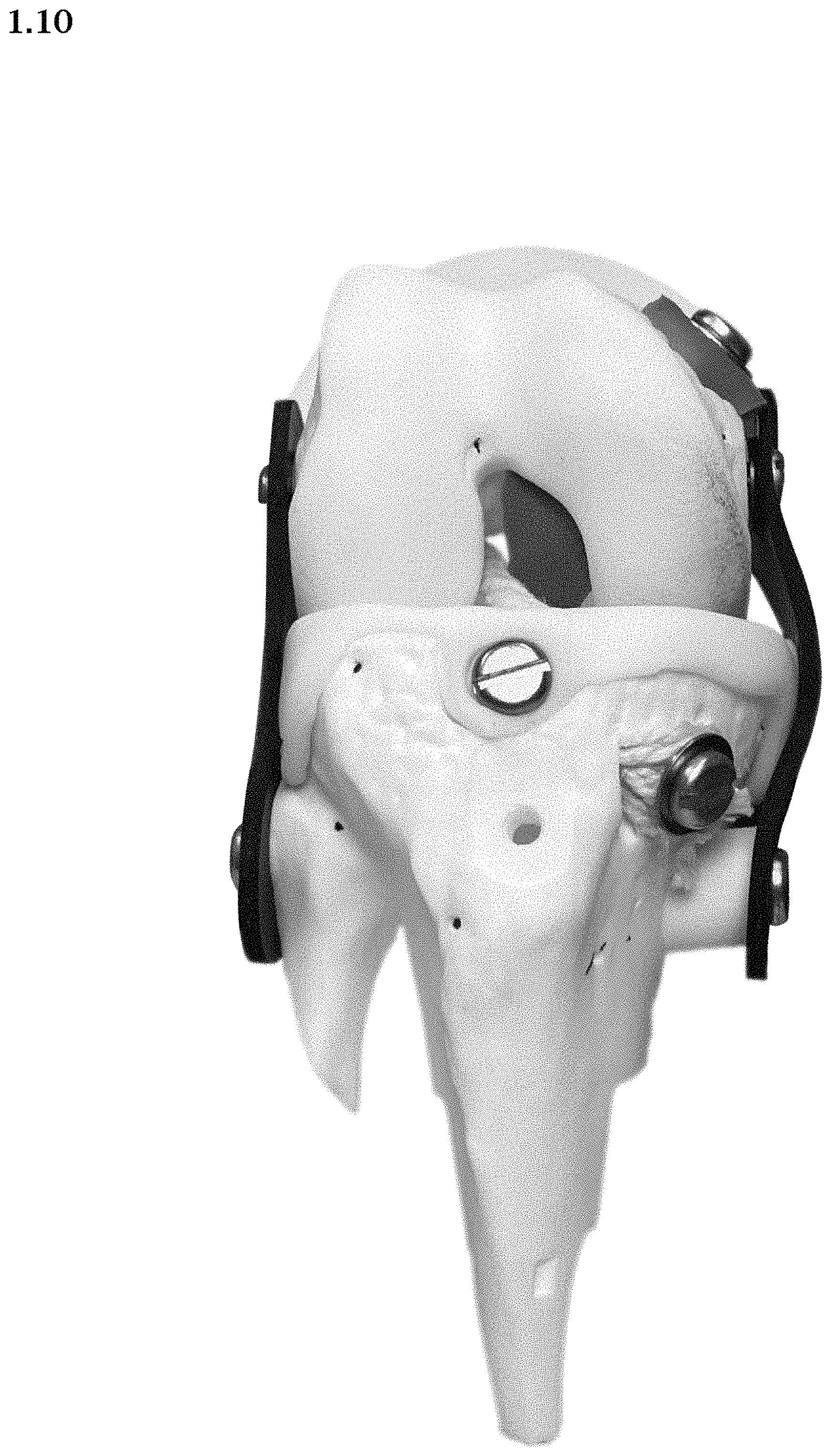 Patent USD1000614 Figure 10 – Artificial knee prosthetics