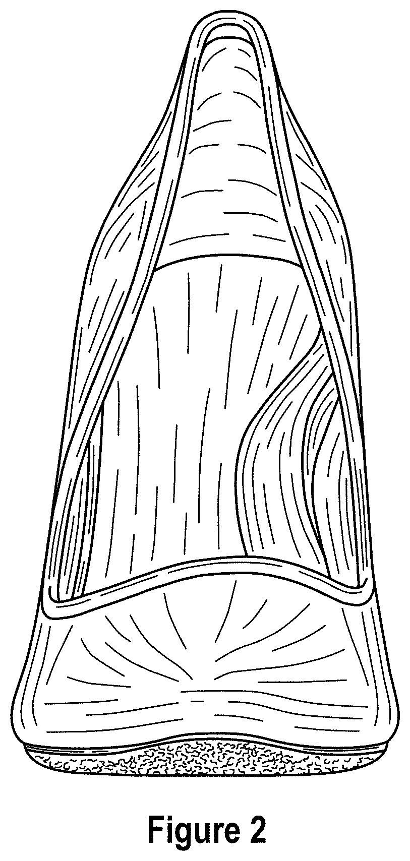 Patent USD1000765 Figure 2 – Shoe with wedge and outsole patch