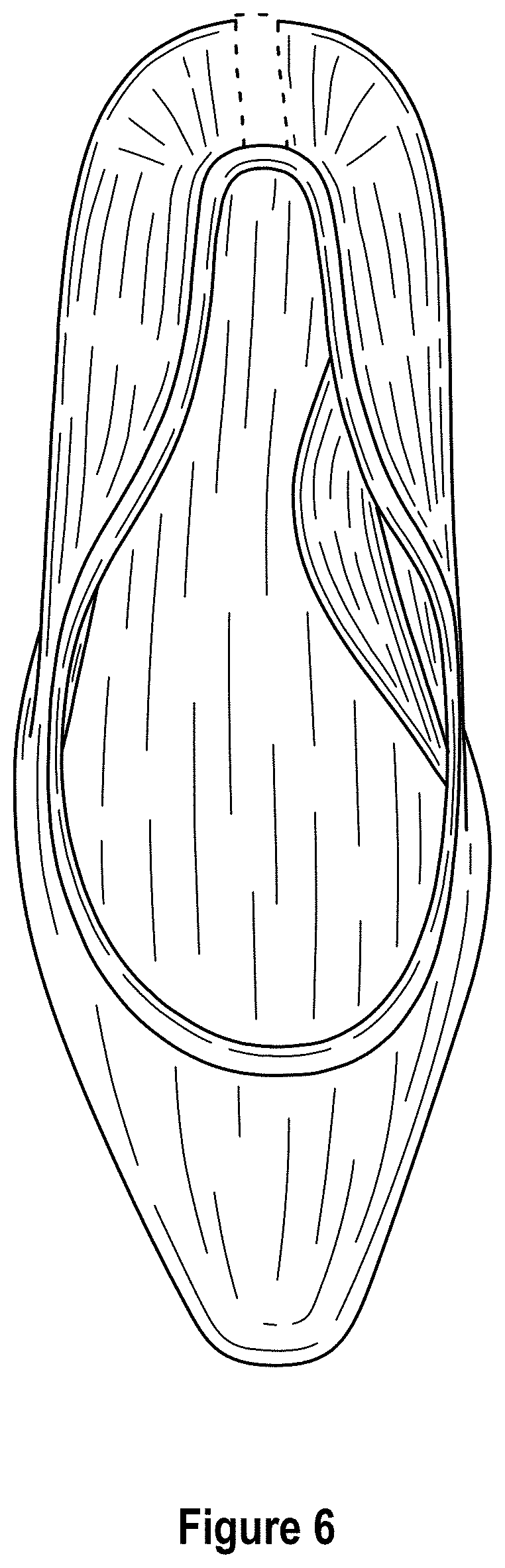 Patent USD1000765 Figure 6 – Shoe with wedge and outsole patch