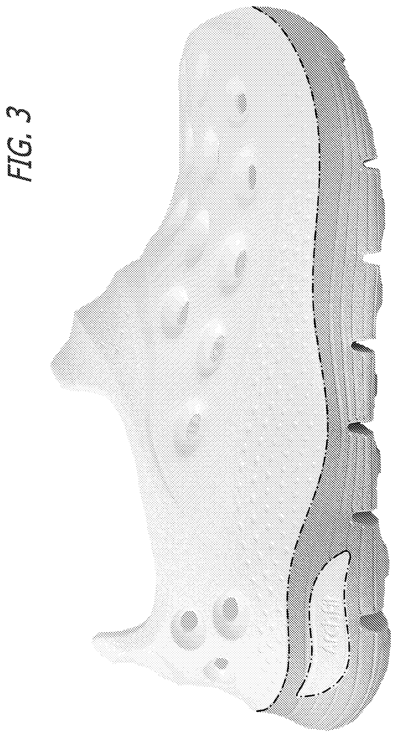 Patent USD1000778 Figure 3 – Shoe outsole bottom