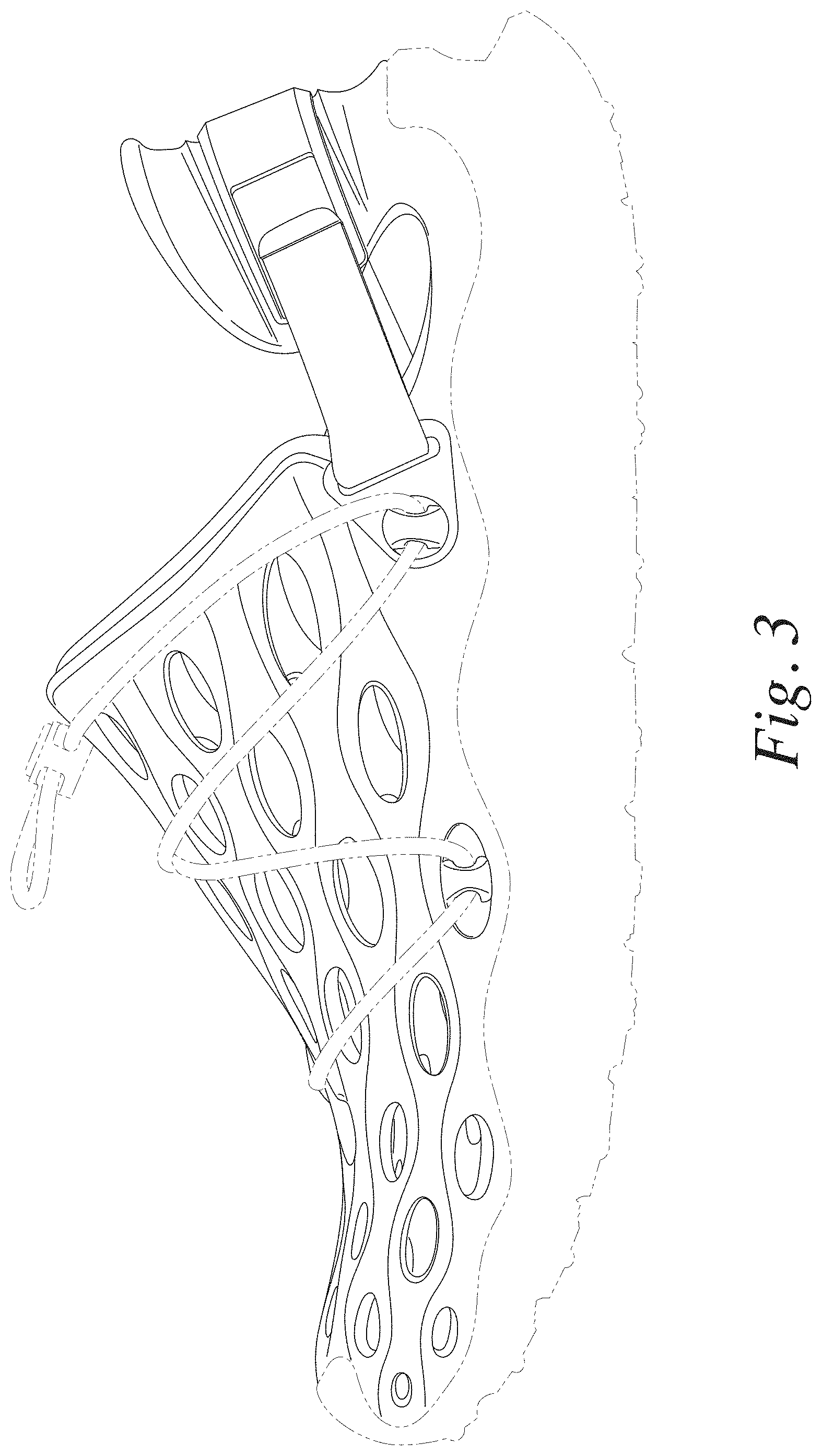 Patent USD1000796 Figure 3 – Footwear upper
