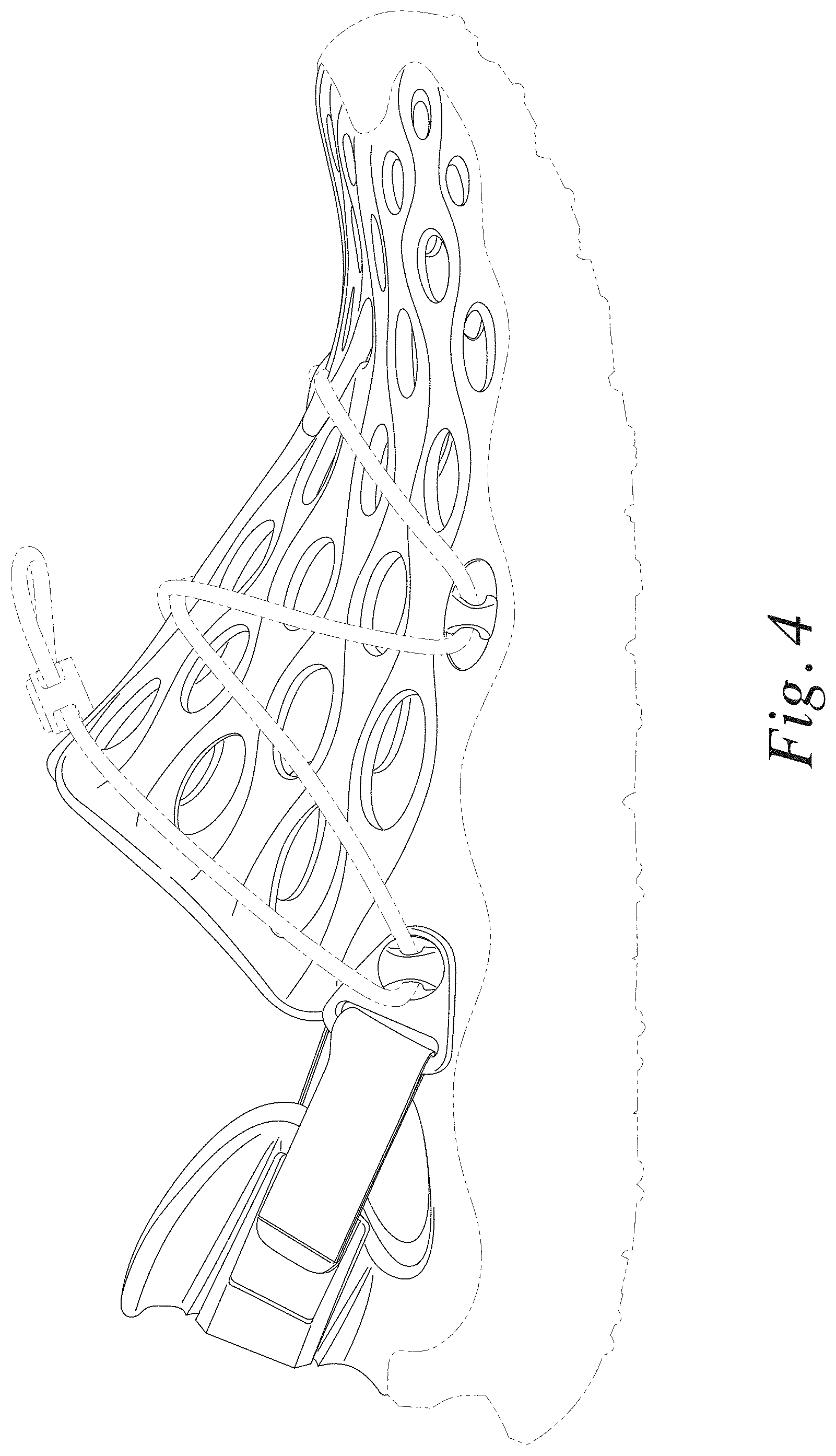 Patent USD1000796 Figure 4 – Footwear upper