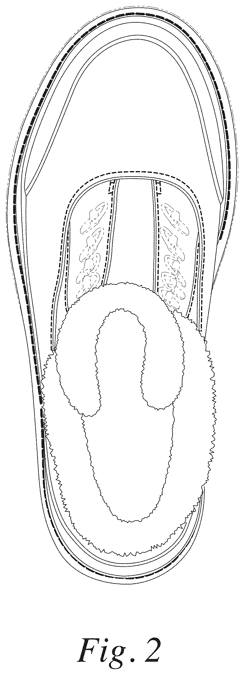 Patent USD1000806 Figure 2 – Footwear upper