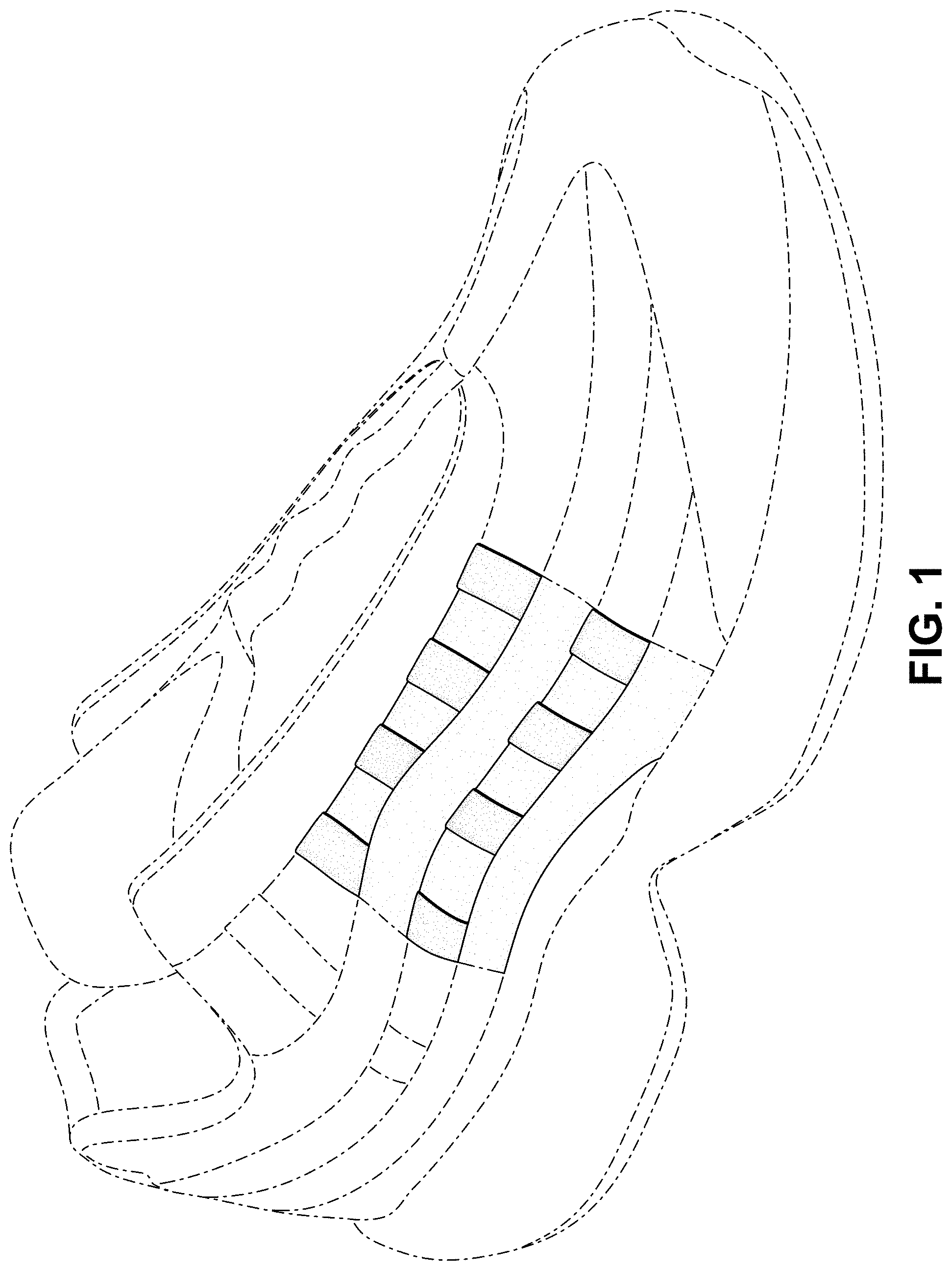 Patent USD1000815 Figure 1 – Shoe